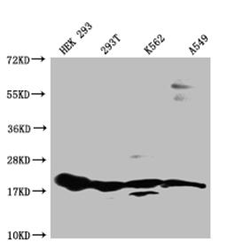 Western Blot. Positive WB detected in: HEK293 whole cell lysate, 293T whole cell lysate, K562 whole cell lysate, A549 whole cell lysate. All lanes: RPS19 antibody at 1:1000. Secondary. Goat polyclonal to rabbit IgG at 1/50000 dilution. Predicted band size: 17 kDa. Observed band size: 15-20 kDa. 