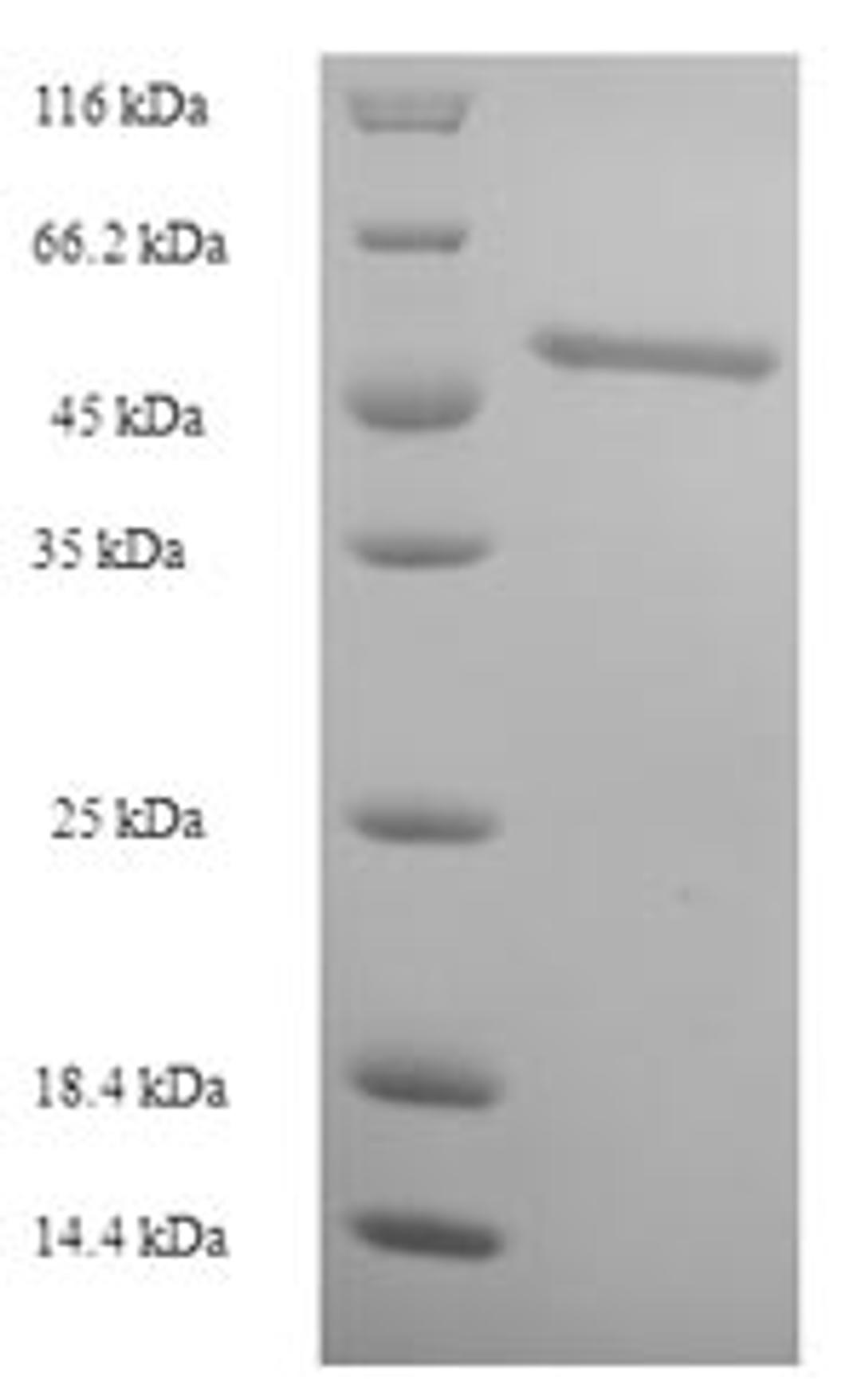 (Tris-Glycine gel) Discontinuous SDS-PAGE (reduced) with 5% enrichment gel and 15% separation gel.