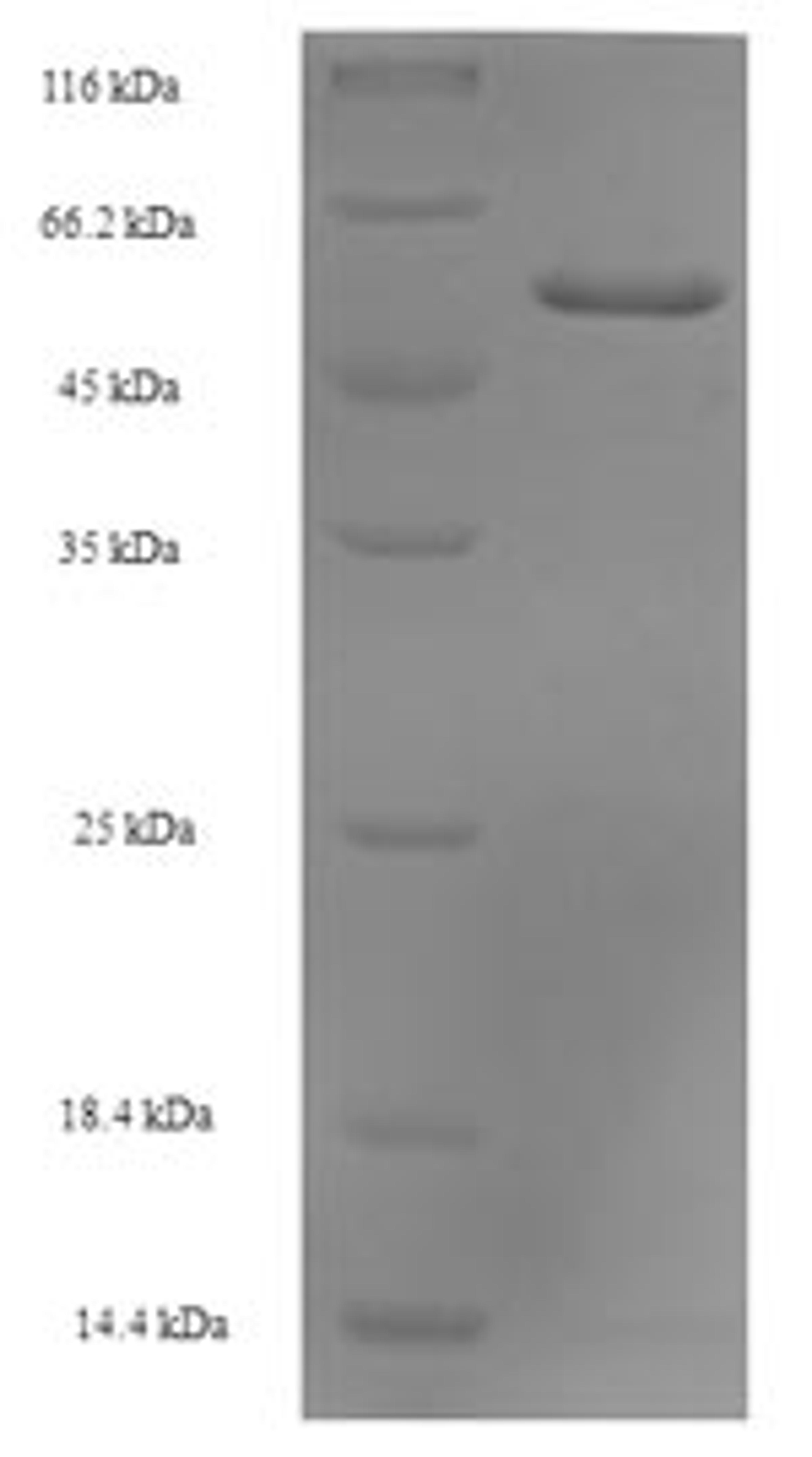 (Tris-Glycine gel) Discontinuous SDS-PAGE (reduced) with 5% enrichment gel and 15% separation gel.