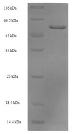 (Tris-Glycine gel) Discontinuous SDS-PAGE (reduced) with 5% enrichment gel and 15% separation gel.
