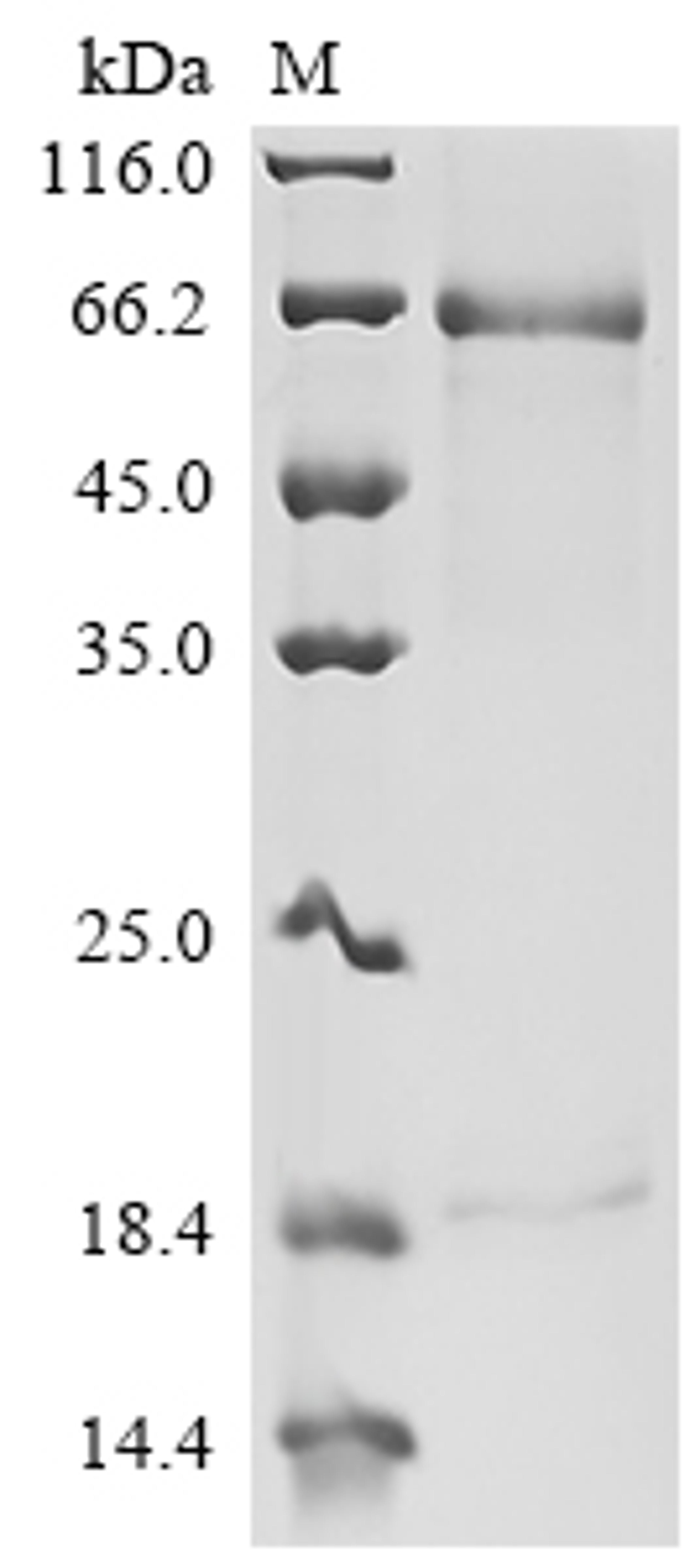 (Tris-Glycine gel) Discontinuous SDS-PAGE (reduced) with 5% enrichment gel and 15% separation gel.