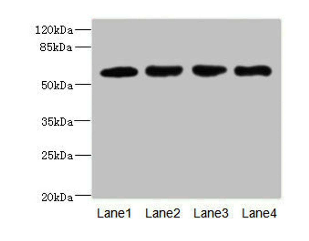 Western blot. All lanes: IL21R antibody at 2.18ug/ml. Lane 1: A549 whole cell lysate. Lane 2: Raji whole cell lysate. Lane 3: Colo320 whole cell lysate. Lane 4: K562 whole cell lysate. Secondary. Goat polyclonal to rabbit IgG at 1/10000 dilution. Predicted band size: 59 kDa. Observed band size: 59 kDa. 