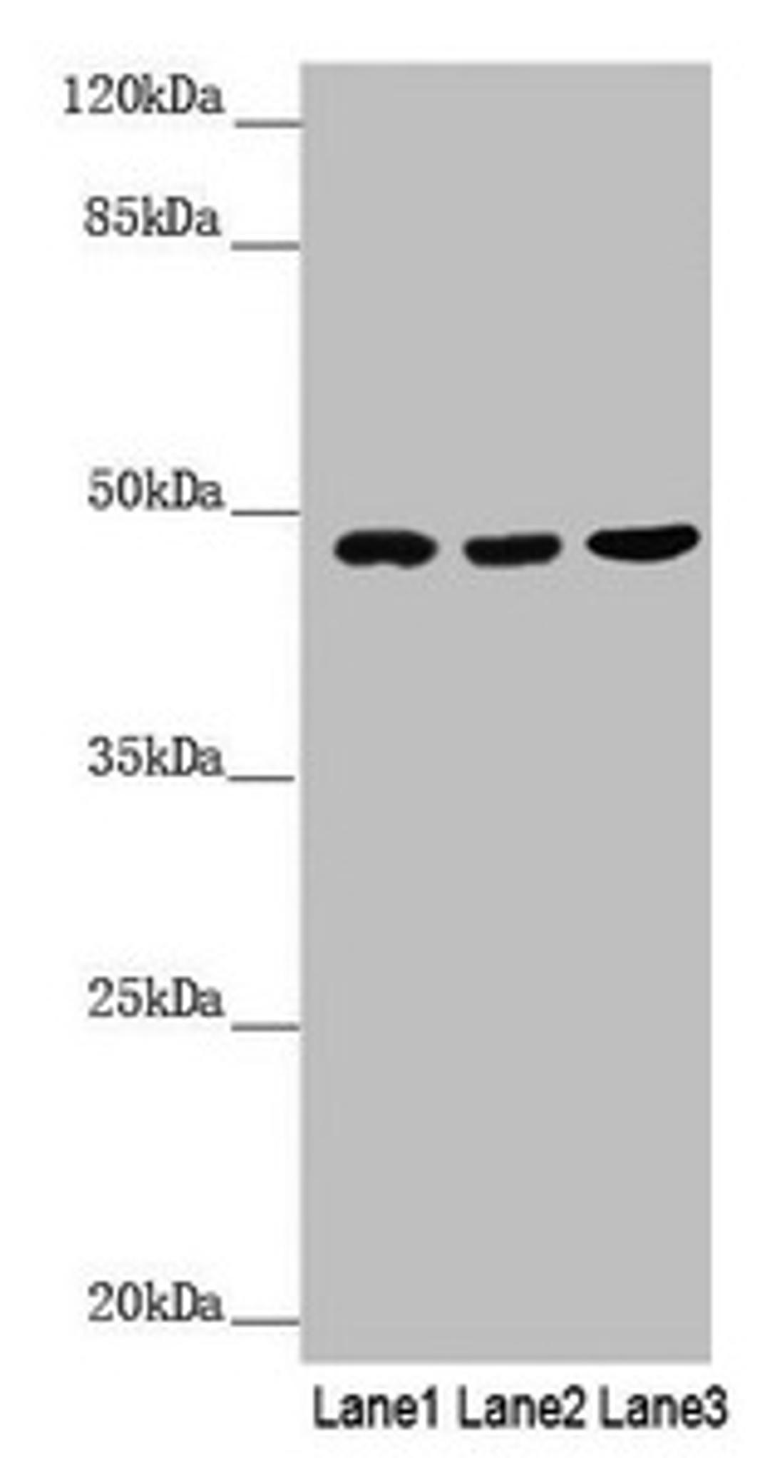 Western blot. All lanes: BCS1L antibody at 3.07µg/ml. Lane 1: A549 whole cell lysate. Lane 2: 293T whole cell lysate. Lane 3: Hela whole cell lysate. Secondary. Goat polyclonal to rabbit IgG at 1/10000 dilution. Predicted band size: 48 kDa. Observed band size: 48 kDa