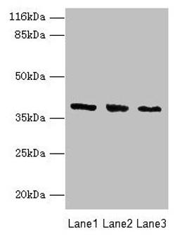 Western blot. All lanes: GALE antibody at 2µg/ml. Lane 1: HepG2 whole cell lysate. Lane 2: Hela whole cell lysate. Lane 3: A549 whole cell lysate. Secondary. Goat polyclonal to rabbit IgG at 1/10000 dilution. Predicted band size: 39, 31 kDa. Observed band size: 39 kDa