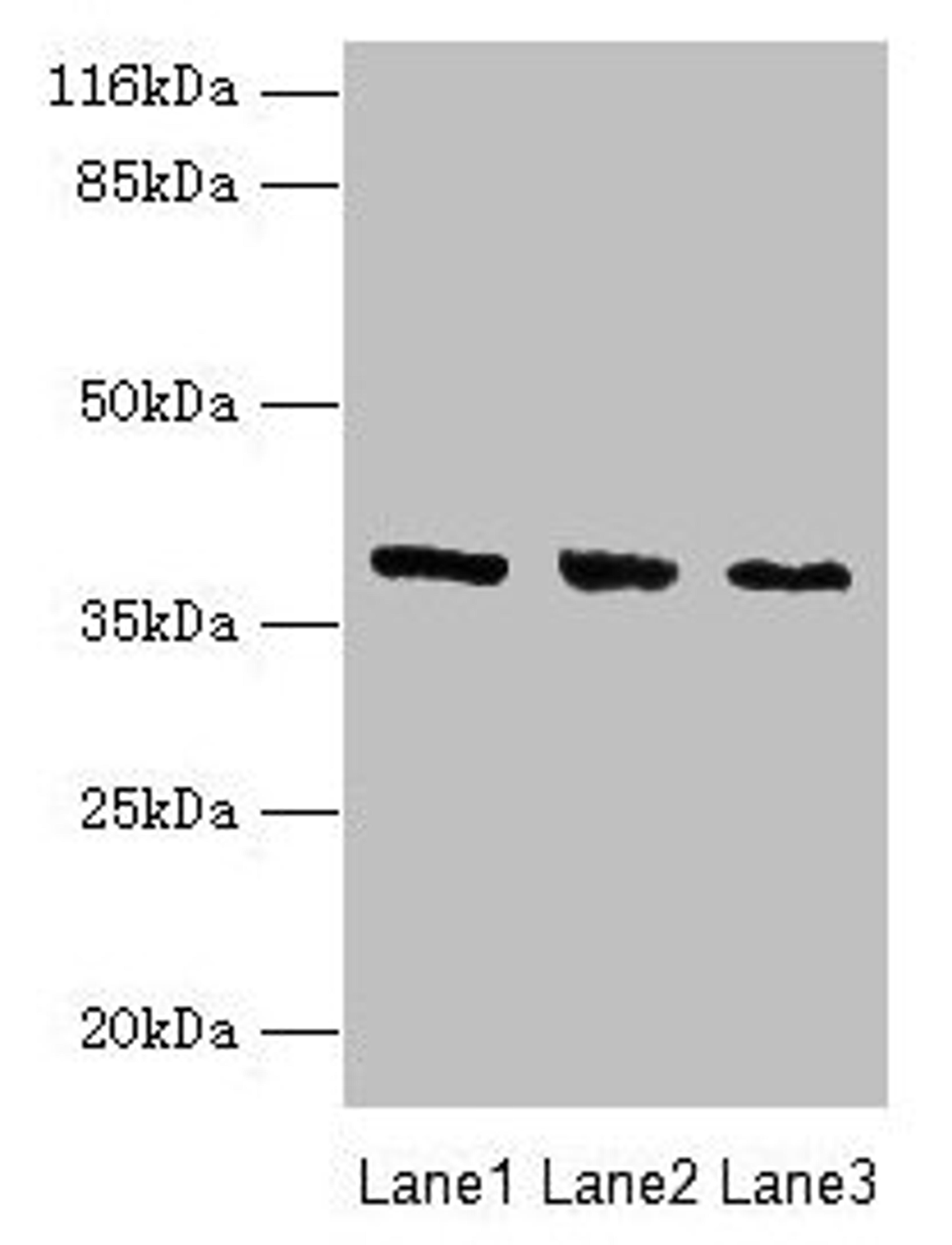 Western blot. All lanes: GALE antibody at 2µg/ml. Lane 1: HepG2 whole cell lysate. Lane 2: Hela whole cell lysate. Lane 3: A549 whole cell lysate. Secondary. Goat polyclonal to rabbit IgG at 1/10000 dilution. Predicted band size: 39, 31 kDa. Observed band size: 39 kDa