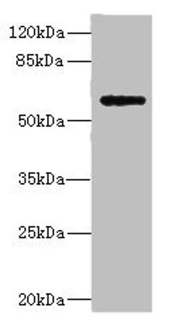 Western blot. All lanes: COX10 antibody at 5.84ug/ml + Mouse heart tissue. Secondary. Goat polyclonal to rabbit IgG at 1/10000 dilution. Predicted band size: 61, 60, 63 kDa. Observed band size: 61 kDa. 