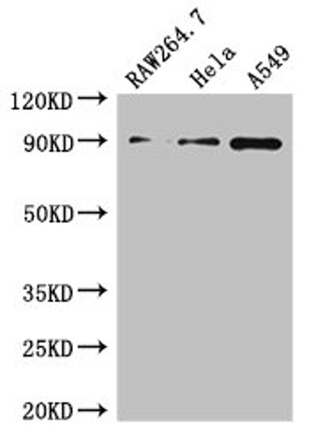 Western Blot. Positive WB detected in: RAW264.7 whole cell lysate, Hela whole cell lysate, A549 whole cell lysate. All lanes: TNFAIP3 antibody at 2.7µg/ml. Secondary. Goat polyclonal to rabbit IgG at 1/50000 dilution. Predicted band size: 90 kDa. Observed band size: 90 kDa