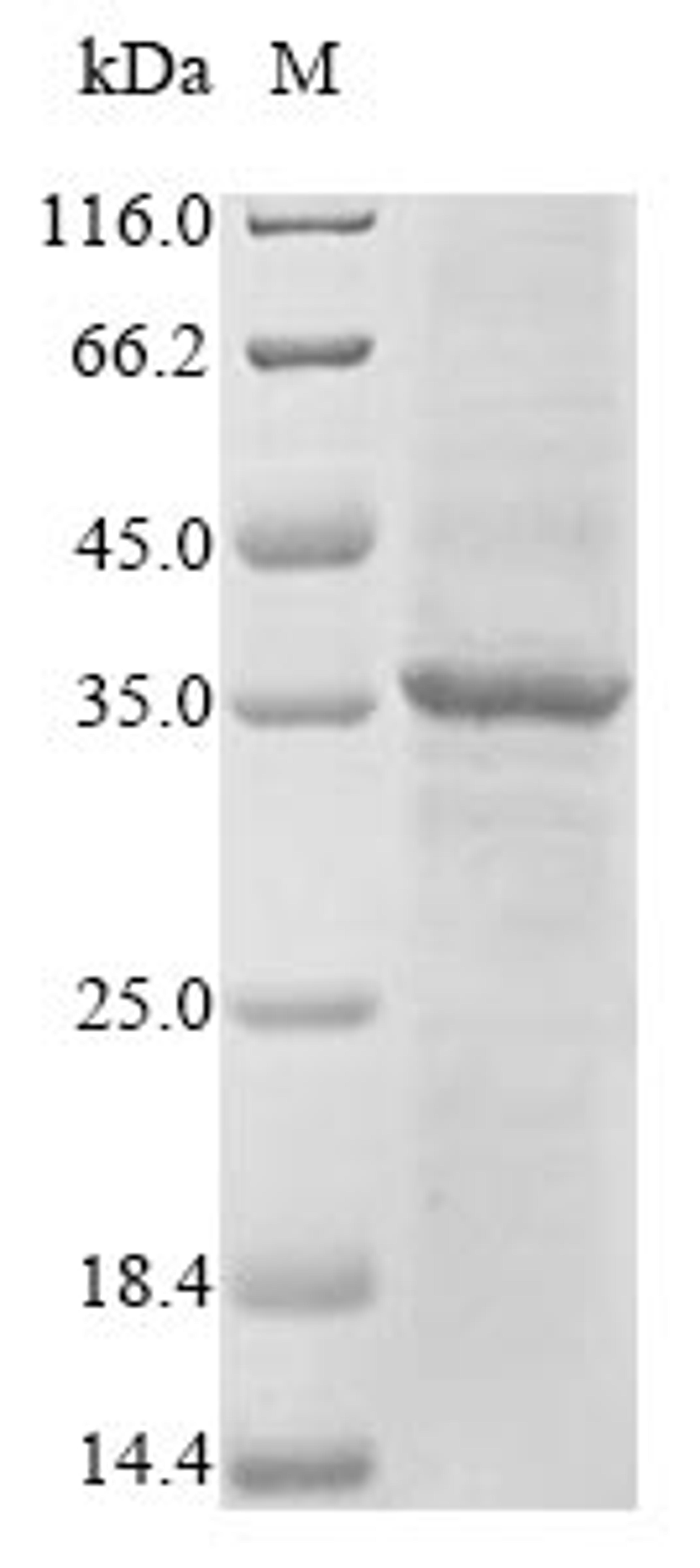 (Tris-Glycine gel) Discontinuous SDS-PAGE (reduced) with 5% enrichment gel and 15% separation gel.
