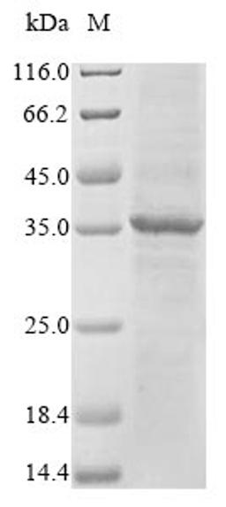 (Tris-Glycine gel) Discontinuous SDS-PAGE (reduced) with 5% enrichment gel and 15% separation gel.