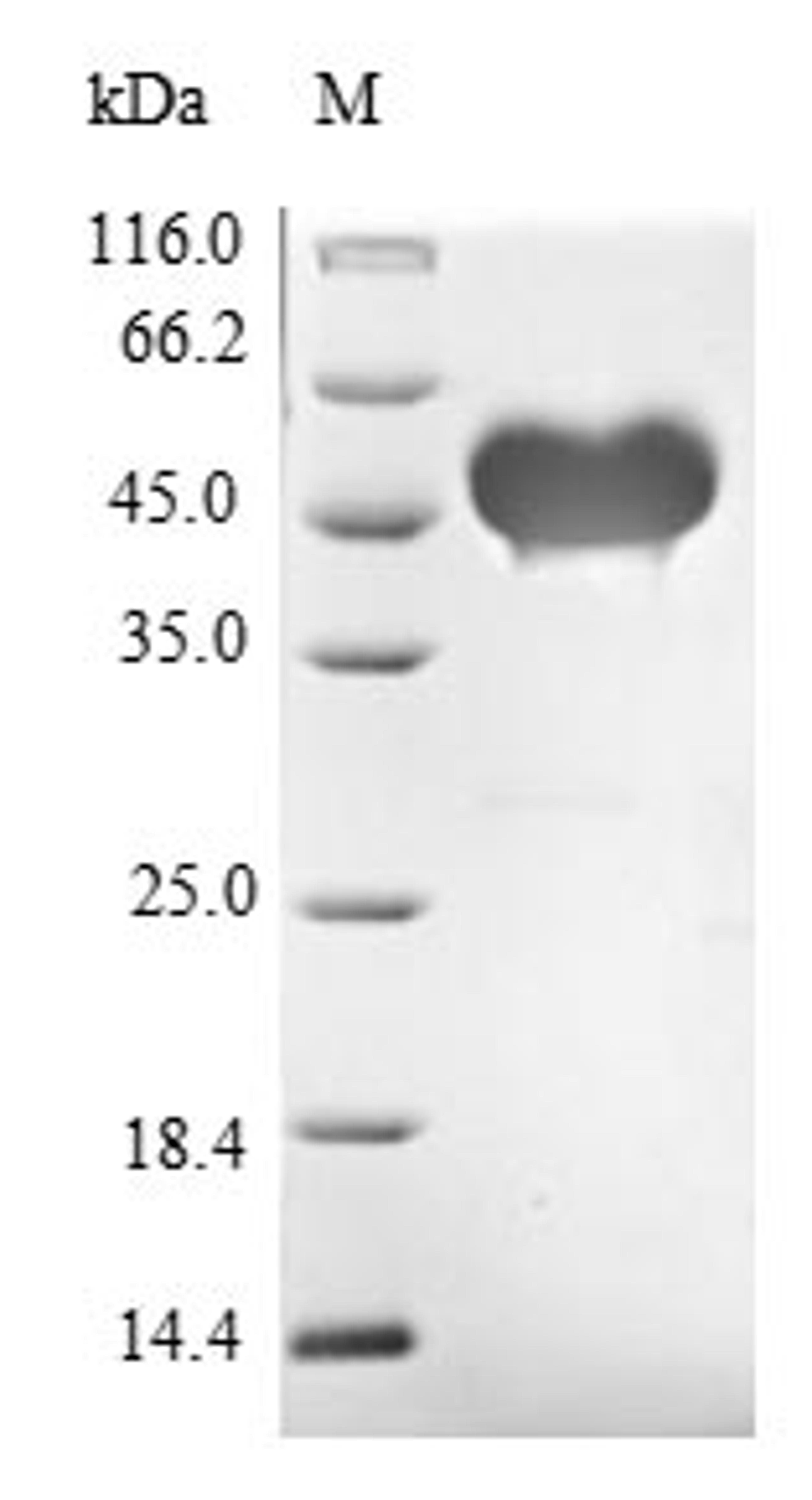 (Tris-Glycine gel) Discontinuous SDS-PAGE (reduced) with 5% enrichment gel and 15% separation gel.