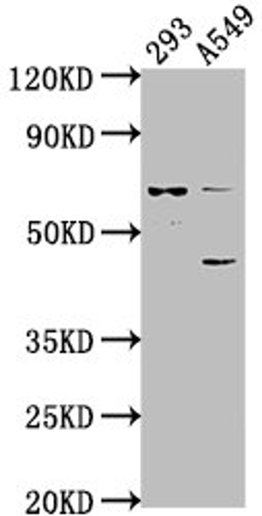 Western Blot. Positive WB detected in: 293 whole cell lysate, A549 whole cell lysate. All lanes: CRTAC1 antibody at 1:1000. Secondary. Goat polyclonal to rabbit IgG at 1/50000 dilution. Predicted band size: 72, 71, 69 kDa. Observed band size: 72 kDa. 