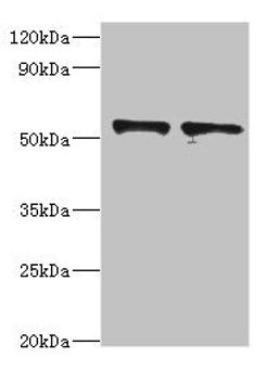 Western blot. All lanes: SPTLC1 antibody at 8µg/ml. Lane 1: 293T whole cell lysate. Lane 2: MCF-7 whole cell lysate. Secondary. Goat polyclonal to rabbit at 1/10000 dilution. Predicted band size: 53, 17 kDa. Observed band size: 53 kDa