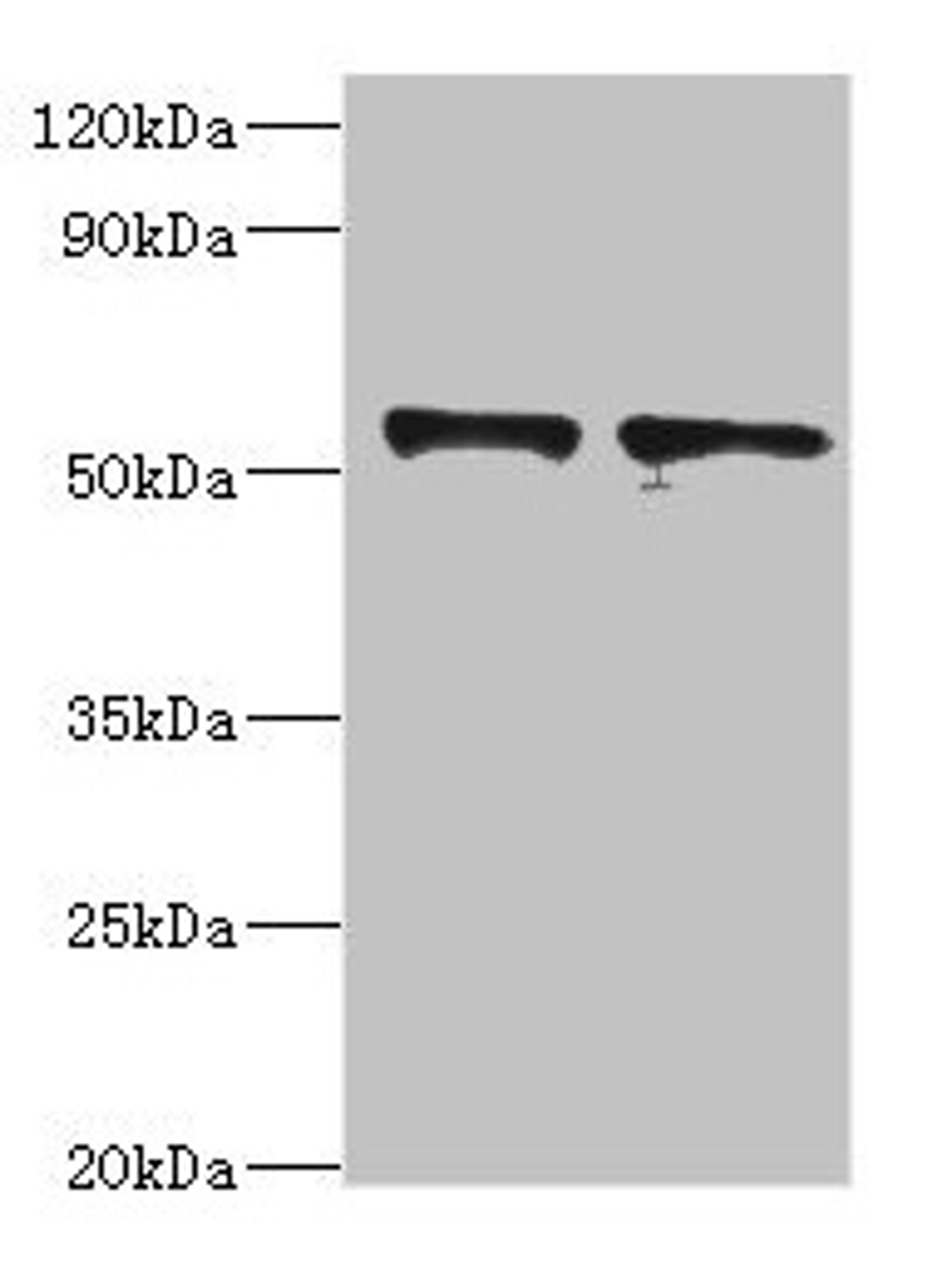 Western blot. All lanes: SPTLC1 antibody at 8µg/ml. Lane 1: 293T whole cell lysate. Lane 2: MCF-7 whole cell lysate. Secondary. Goat polyclonal to rabbit at 1/10000 dilution. Predicted band size: 53, 17 kDa. Observed band size: 53 kDa