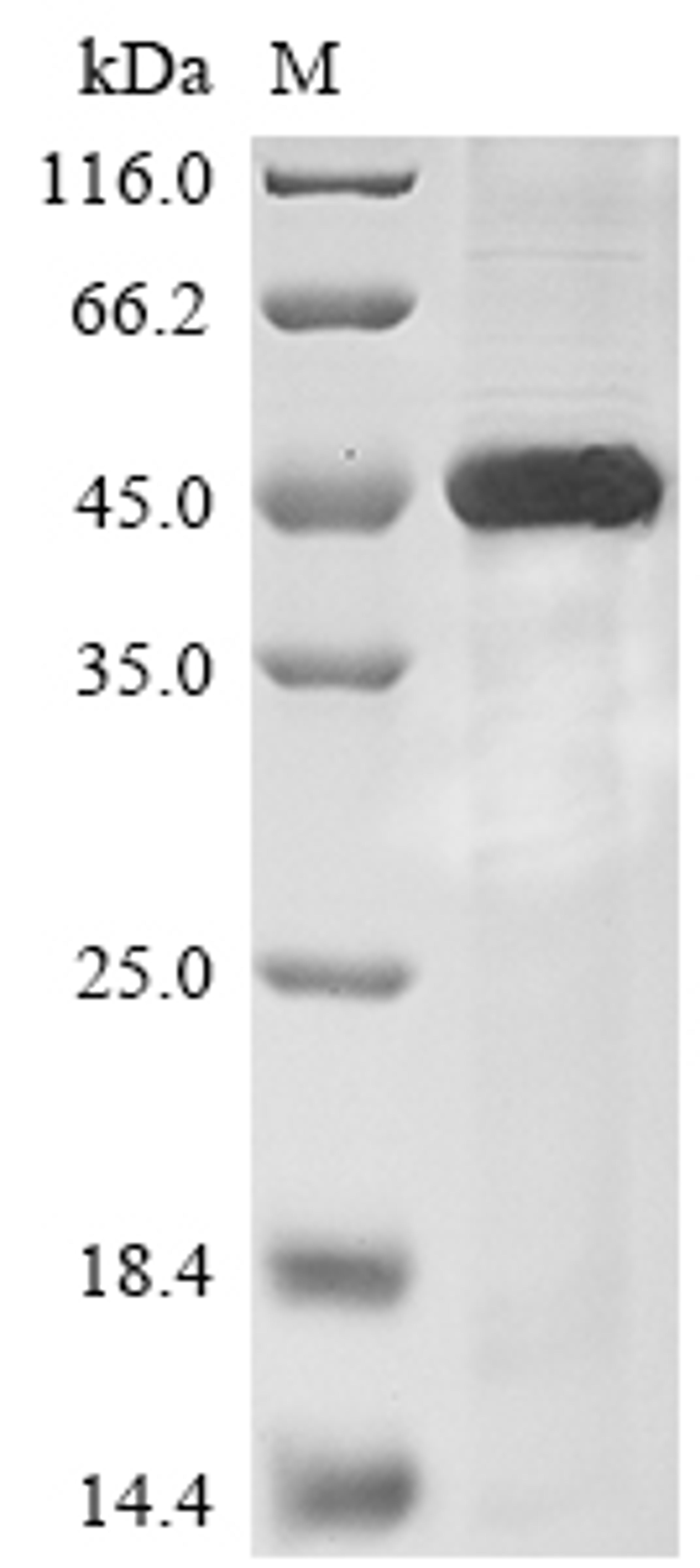 (Tris-Glycine gel) Discontinuous SDS-PAGE (reduced) with 5% enrichment gel and 15% separation gel.