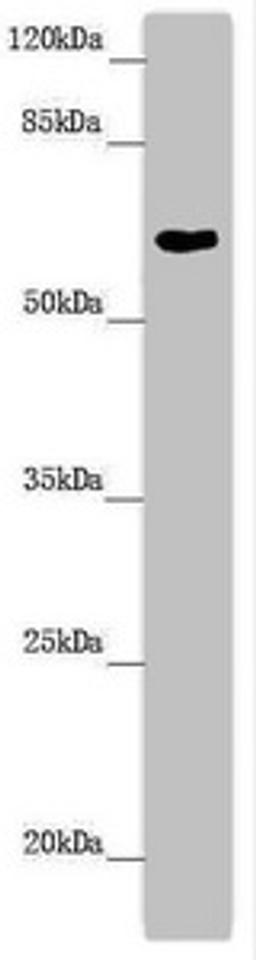 Western blot. All lanes: FMO5 antibody at 6.04 ug/ml + Mouse liver tissue. Secondary. Goat polyclonal to rabbit IgG at 1/10000 dilution. Predicted band size: 61, 33, 53 kDa. Observed band size: 61 kDa. 