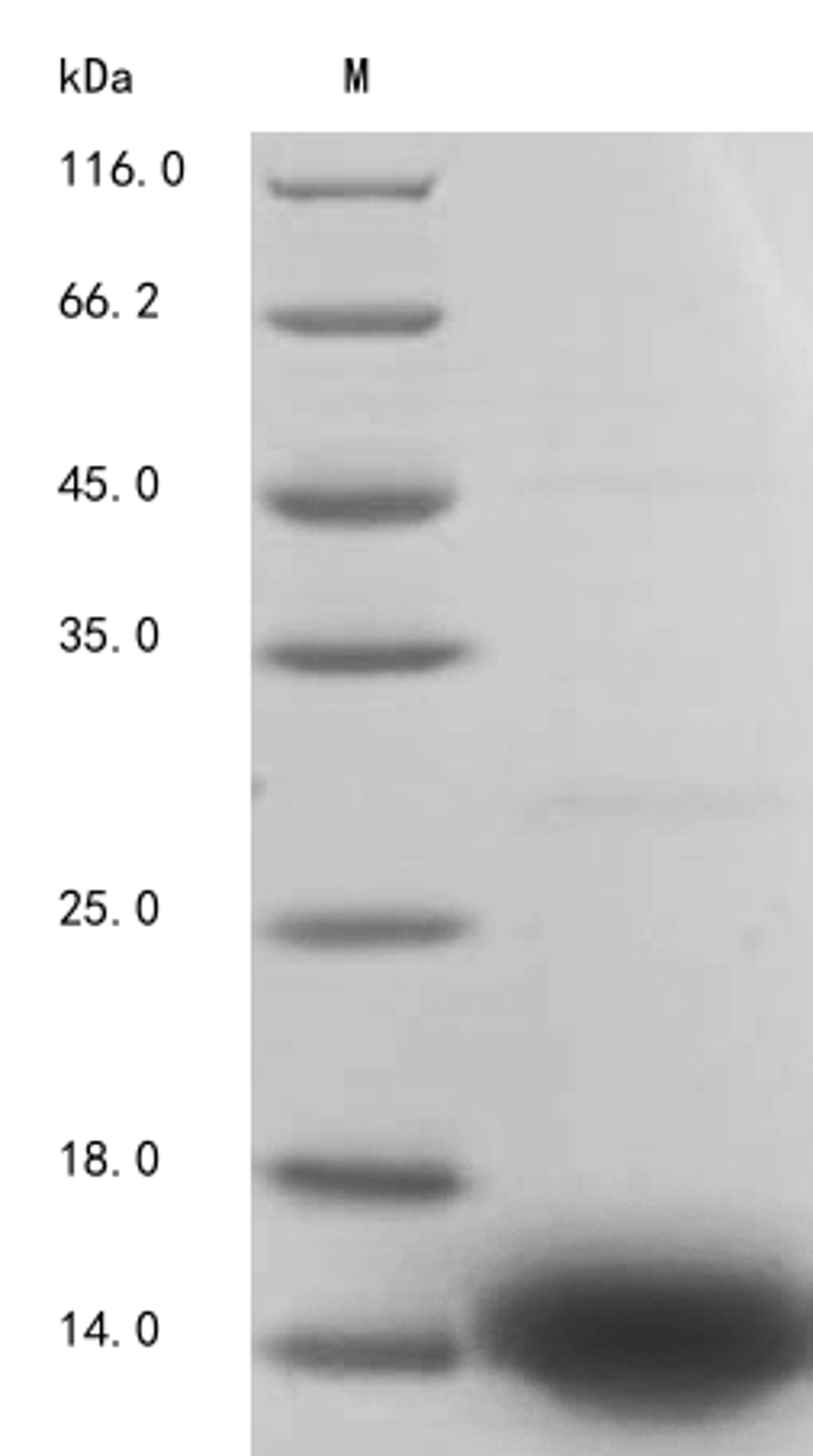 (Tris-Glycine gel) Discontinuous SDS-PAGE (reduced) with 5% enrichment gel and 15% separation gel.