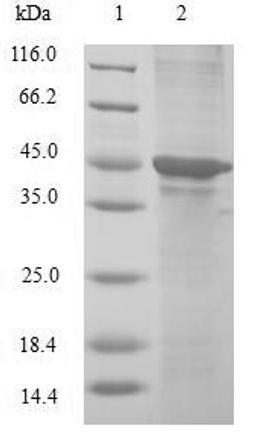 (Tris-Glycine gel) Discontinuous SDS-PAGE (reduced) with 5% enrichment gel and 15% separation gel.