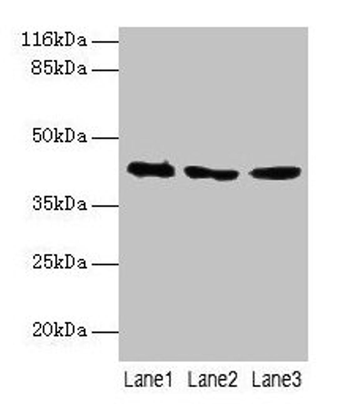Western blot. All lanes: ATXN3 antibody at 2µg/ml. Lane 1: 293T whole cell lysate. Lane 2: Mouse brain tissue. Lane 3: MCF-7 whole cell lysate. Secondary. Goat polyclonal to rabbit IgG at 1/10000 dilution. Predicted band size: 42, 36, 40, 21 kDa. Observed band size: 42 kDa