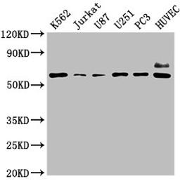 Western Blot. Positive WB detected in: K562 whole cell lysate, Jurkat whole cell lysate, U87 whole cell lysate, U251 whole cell lysate, PC3 whole cell lysate, HUVEC whole cell lysate. All lanes: NT5E antibody at 1:2000. Secondary. Goat polyclonal to rabbit IgG at 1/50000 dilution. Predicted band size: 64, 58 kDa. Observed band size: 64 kDa. 