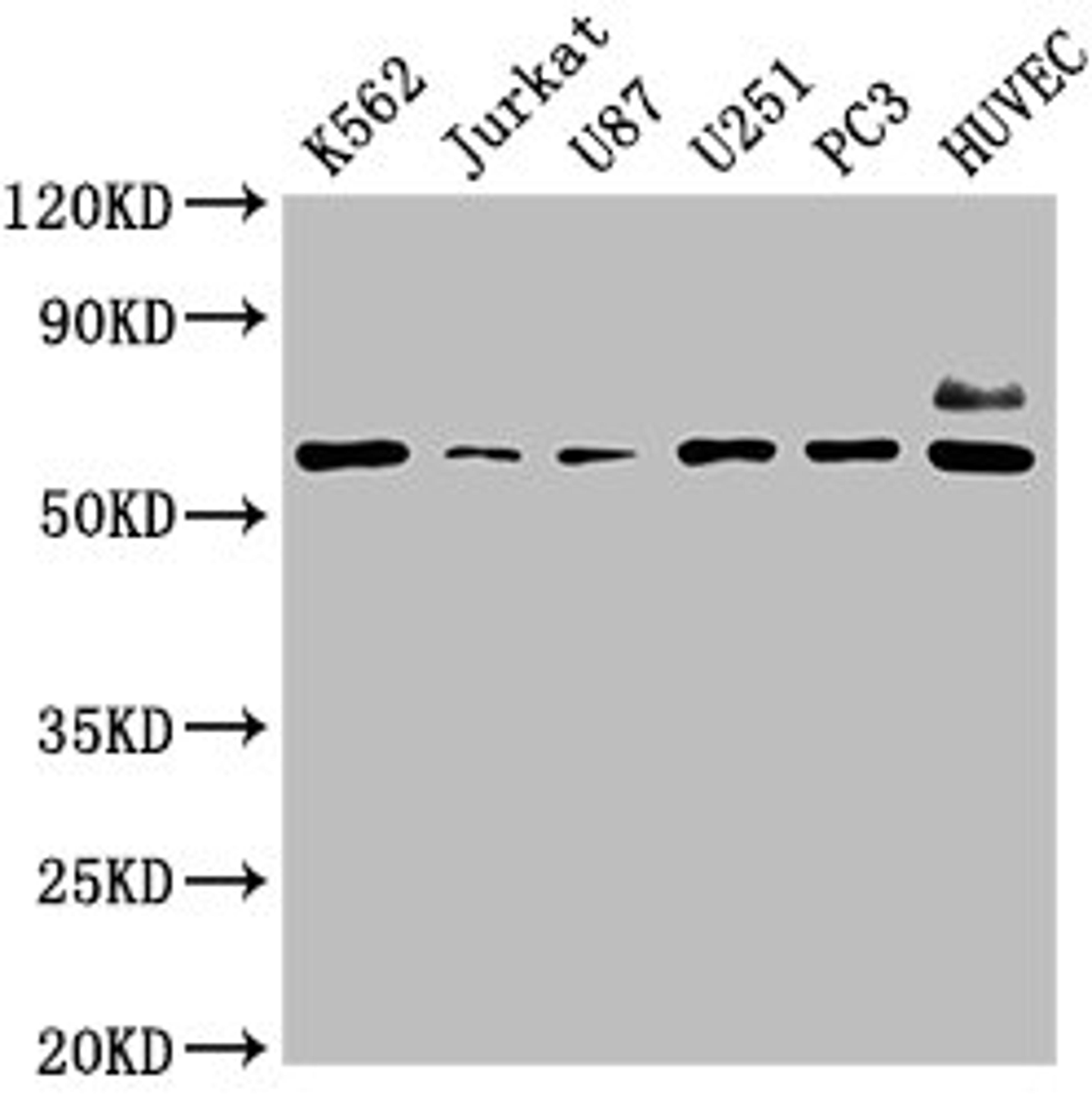 Western Blot. Positive WB detected in: K562 whole cell lysate, Jurkat whole cell lysate, U87 whole cell lysate, U251 whole cell lysate, PC3 whole cell lysate, HUVEC whole cell lysate. All lanes: NT5E antibody at 1:2000. Secondary. Goat polyclonal to rabbit IgG at 1/50000 dilution. Predicted band size: 64, 58 kDa. Observed band size: 64 kDa. 