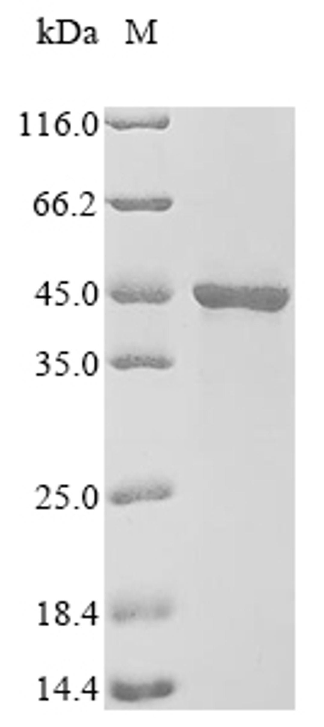 (Tris-Glycine gel) Discontinuous SDS-PAGE (reduced) with 5% enrichment gel and 15% separation gel.