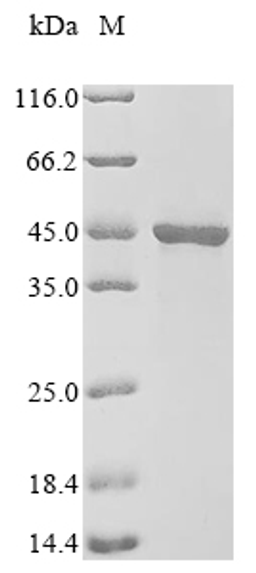 (Tris-Glycine gel) Discontinuous SDS-PAGE (reduced) with 5% enrichment gel and 15% separation gel.