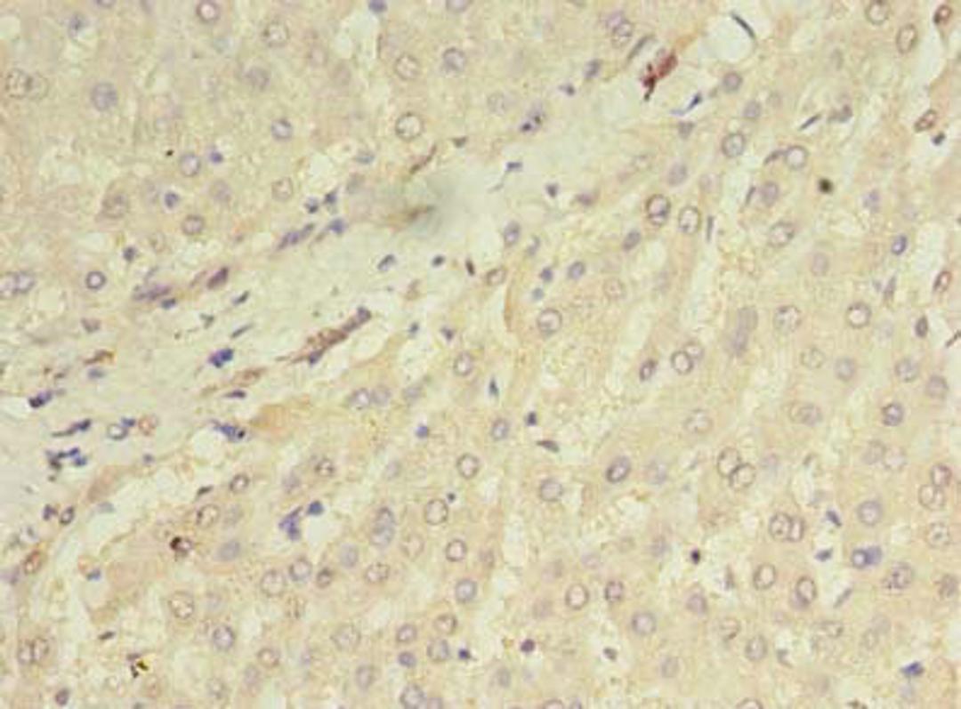 Immunohistochemistry of paraffin-embedded human liver tissue using CSB-PA868379LA01HU at dilution of 1:100