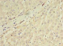 Immunohistochemistry of paraffin-embedded human liver tissue using CSB-PA868379LA01HU at dilution of 1:100