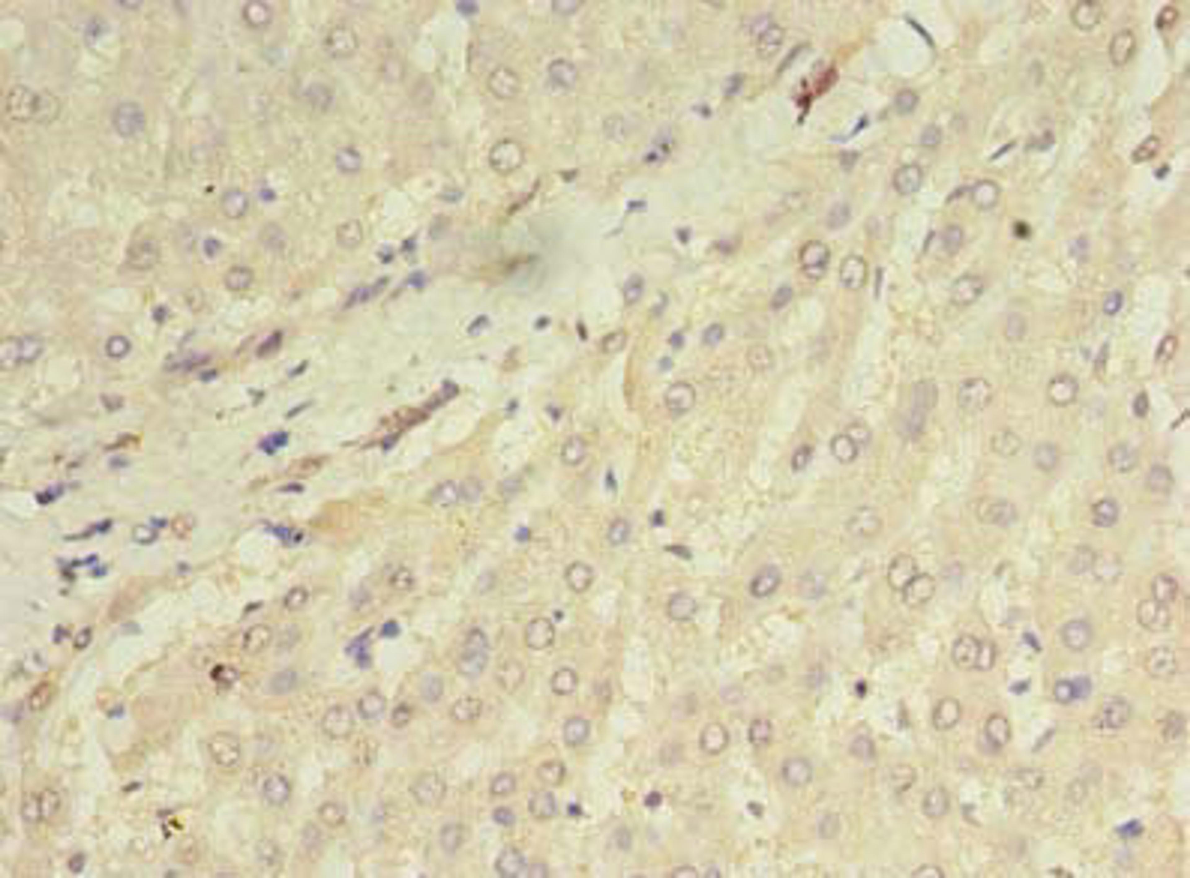 Immunohistochemistry of paraffin-embedded human liver tissue using CSB-PA868379LA01HU at dilution of 1:100