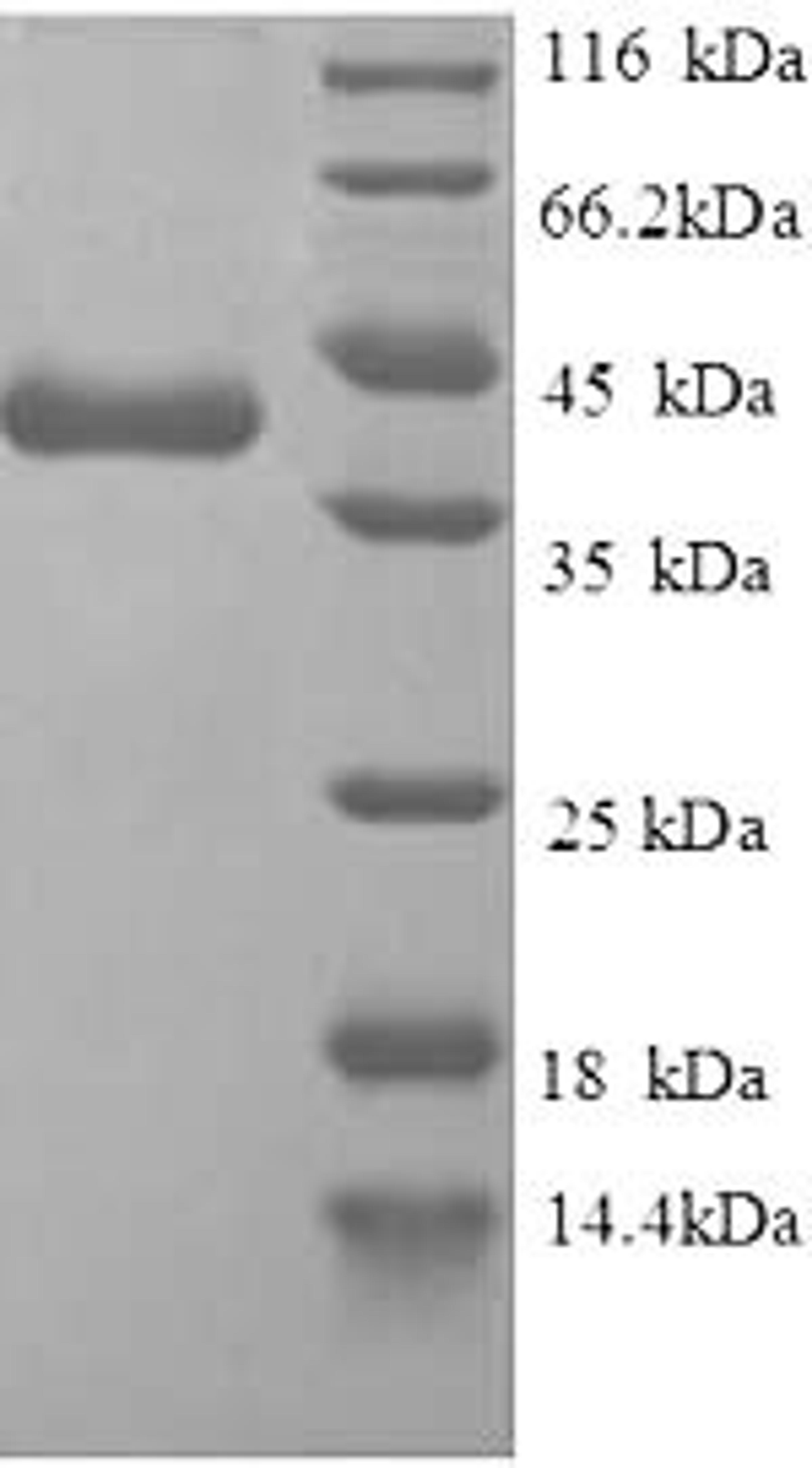 (Tris-Glycine gel) Discontinuous SDS-PAGE (reduced) with 5% enrichment gel and 15% separation gel.