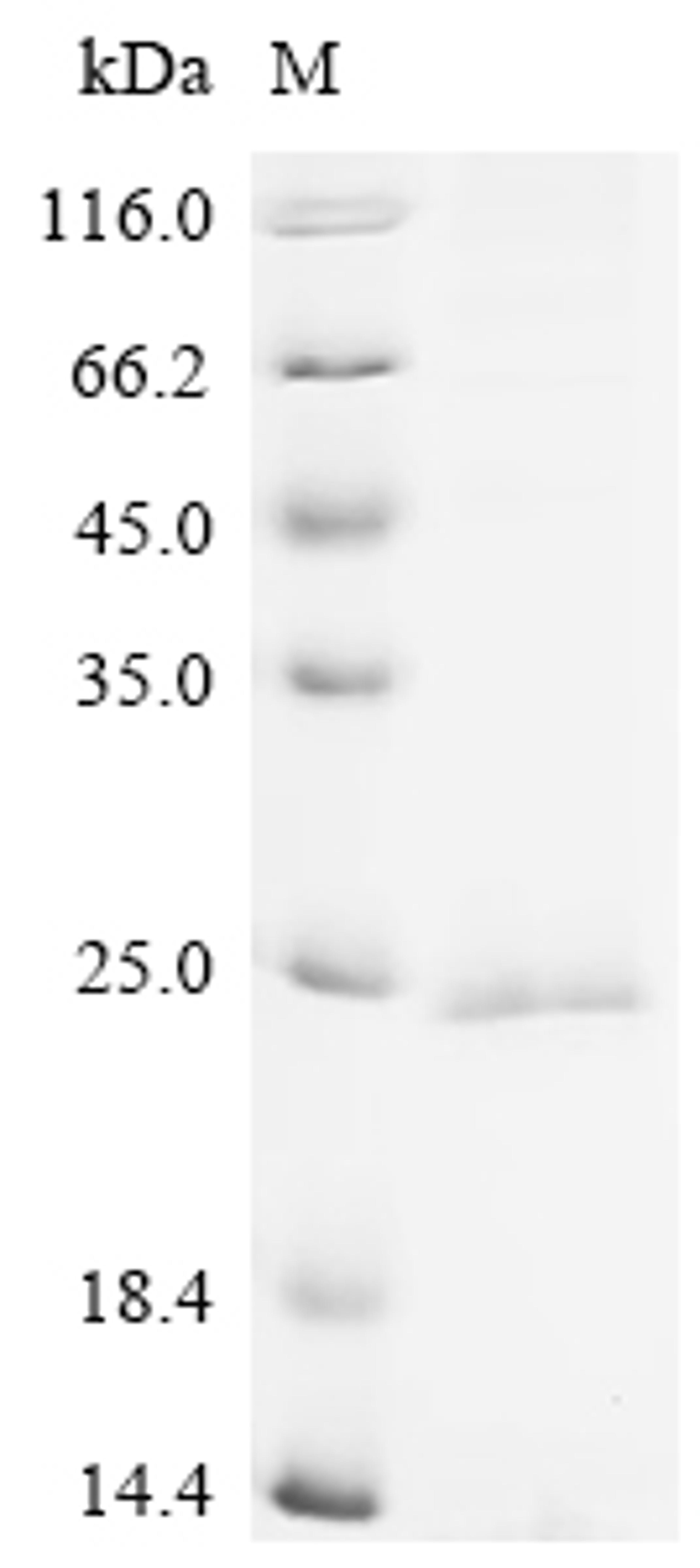 (Tris-Glycine gel) Discontinuous SDS-PAGE (reduced) with 5% enrichment gel and 15% separation gel.