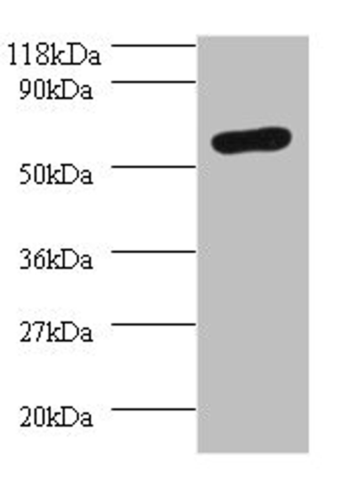 Western blot. All lanes: SEPSECS antibody at 2µg/ml + 293T whole cell lysate. Secondary. Goat polyclonal to rabbit IgG at 1/10000 dilution. Predicted band size: 56, 6 kDa. Observed band size: 56 kDa