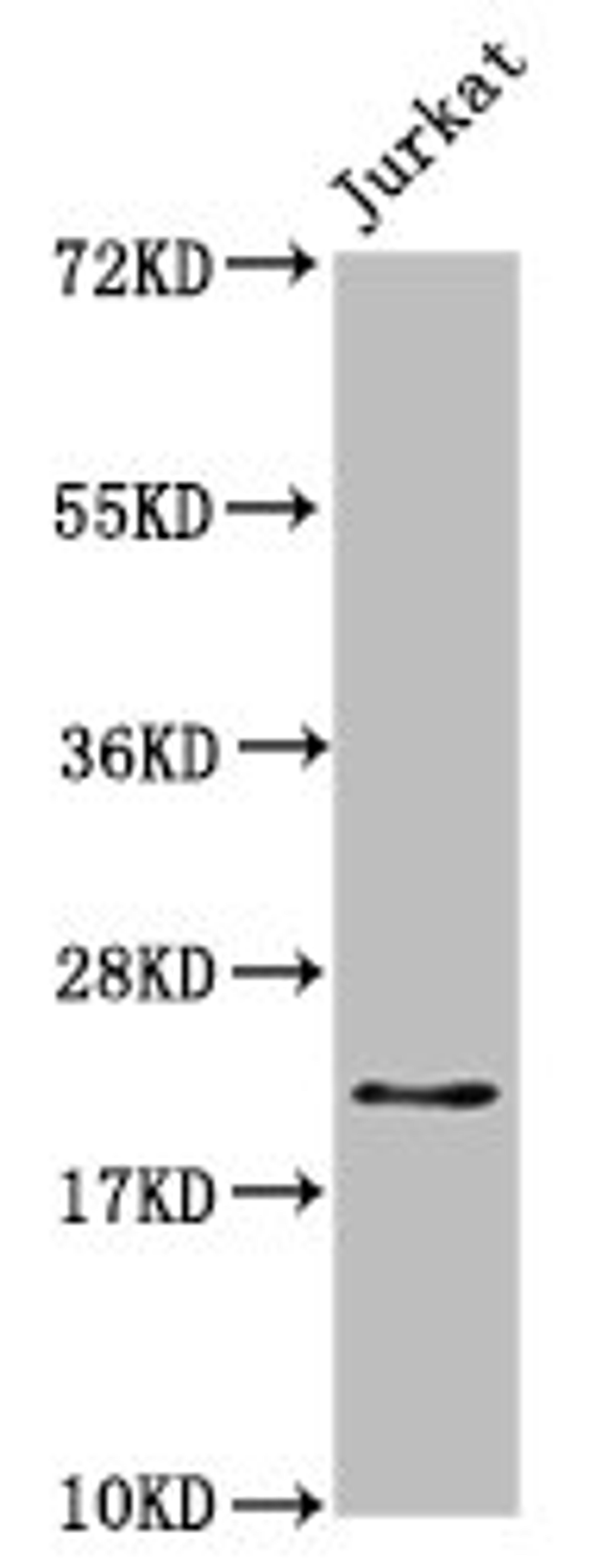 Western Blot. Positive WB detected in: Jurkat whole cell lysate. All lanes: HIST1H1C antibody at 1.7µg/ml. Secondary. Goat polyclonal to rabbit IgG at 1/50000 dilution. Predicted band size: 22 kDa. Observed band size: 22 kDa