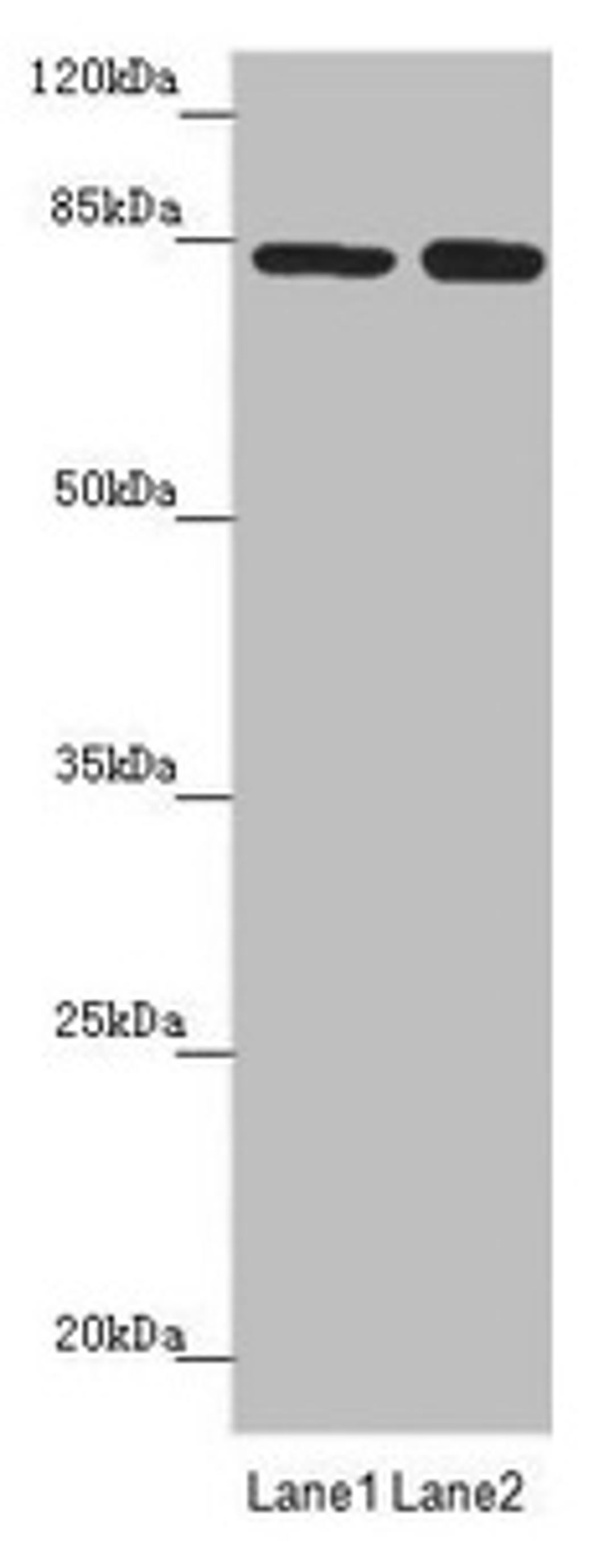 Western blot. All lanes: NELL1 antibody at 4.52µg/ml. Lane 1: Hela whole cell lysate. Lane 2: Jurkat whole cell lysate. Secondary. Goat polyclonal to rabbit IgG at 1/10000 dilution. Predicted band size: 90, 85 kDa. Observed band size: 85 kDa