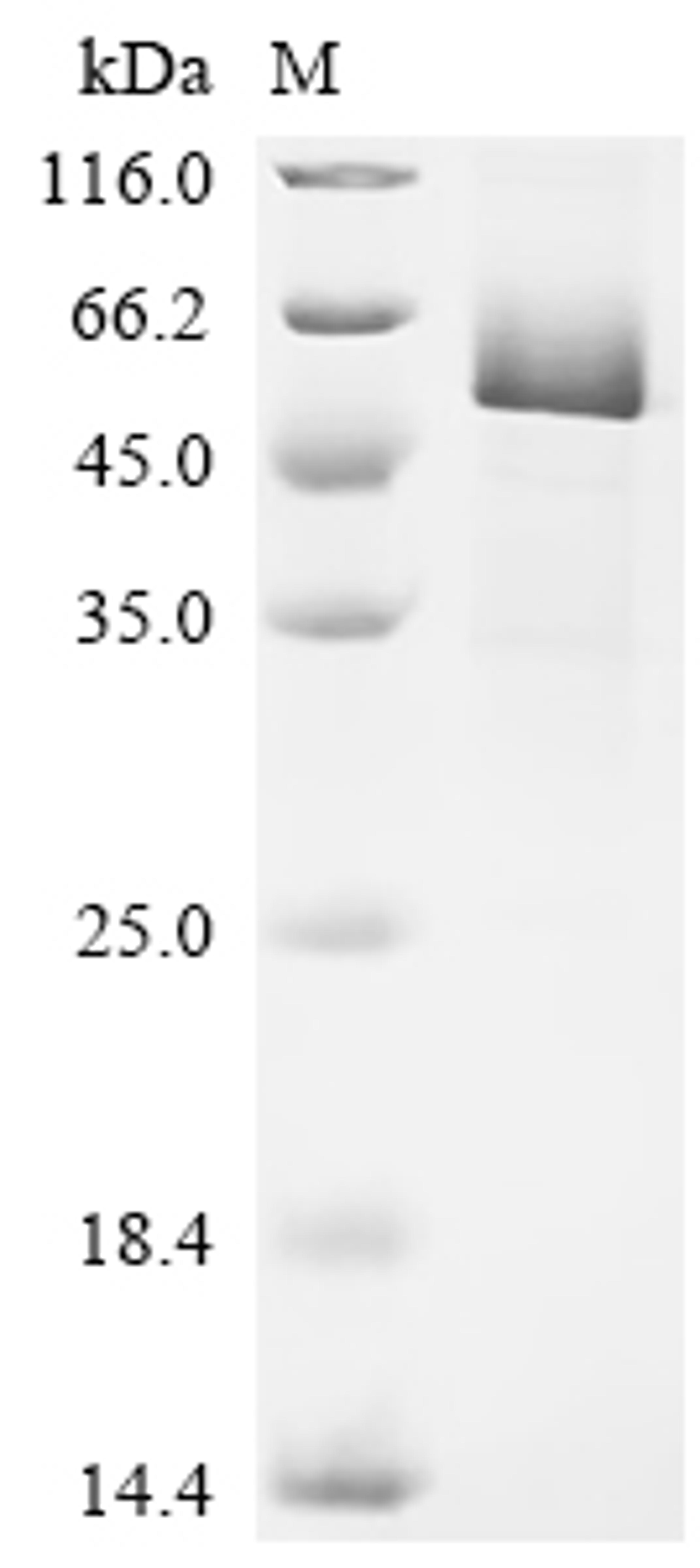 (Tris-Glycine gel) Discontinuous SDS-PAGE (reduced) with 5% enrichment gel and 15% separation gel.