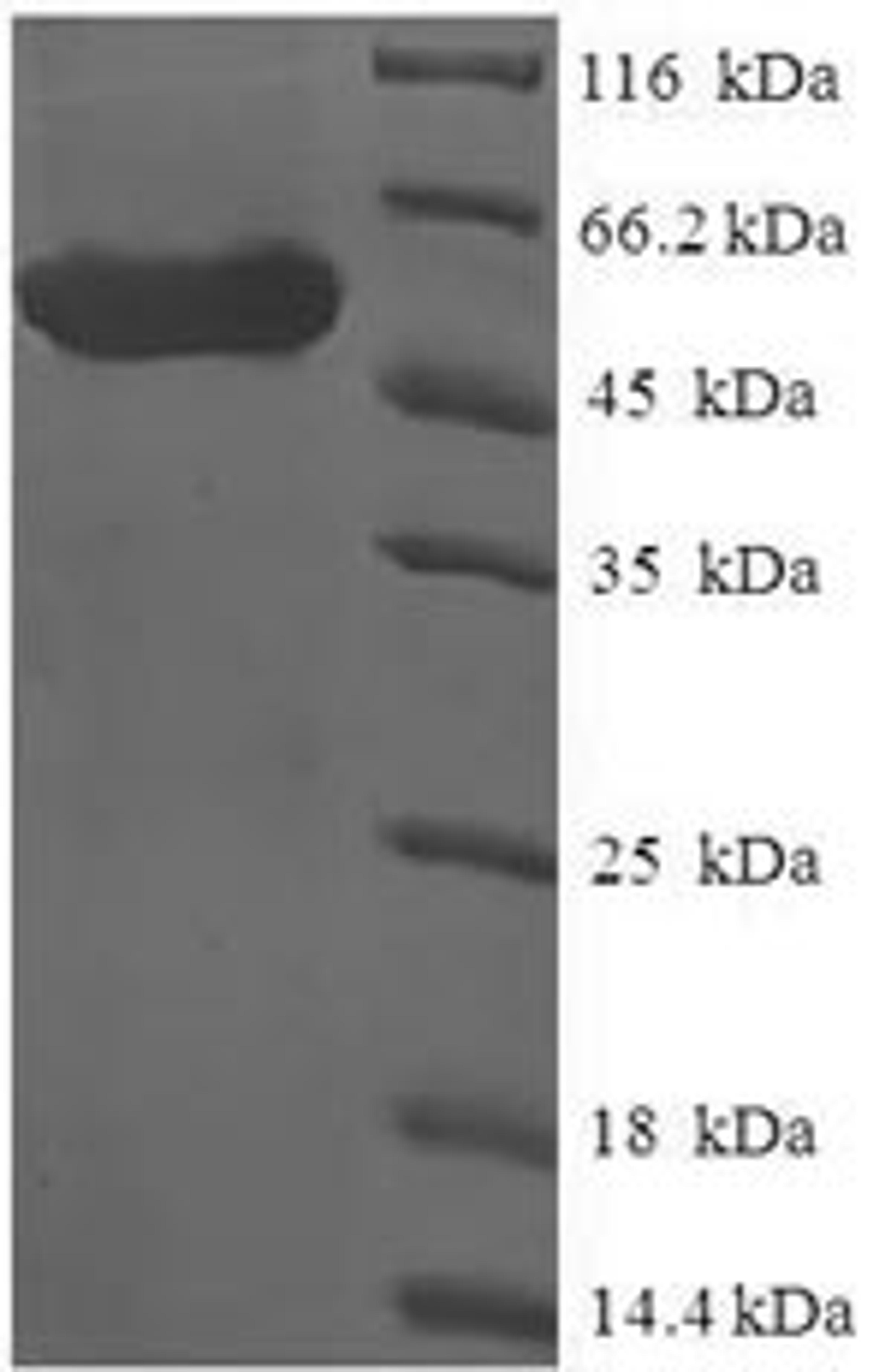 (Tris-Glycine gel) Discontinuous SDS-PAGE (reduced) with 5% enrichment gel and 15% separation gel.