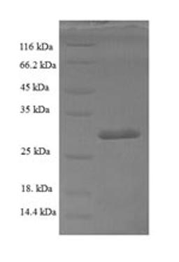 (Tris-Glycine gel) Discontinuous SDS-PAGE (reduced) with 5% enrichment gel and 15% separation gel.