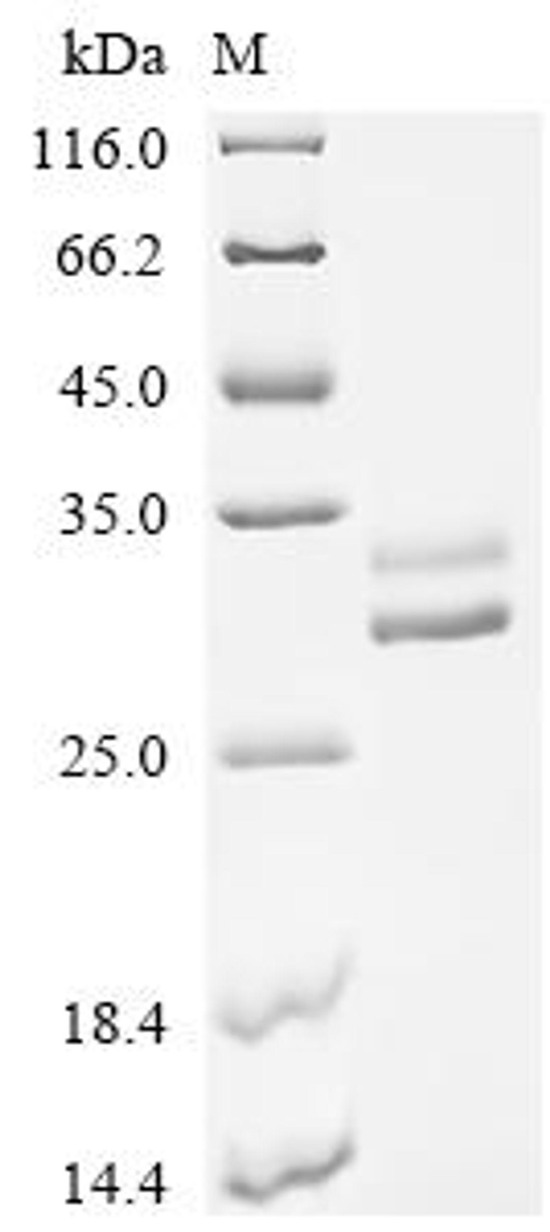 (Tris-Glycine gel) Discontinuous SDS-PAGE (reduced) with 5% enrichment gel and 15% separation gel.