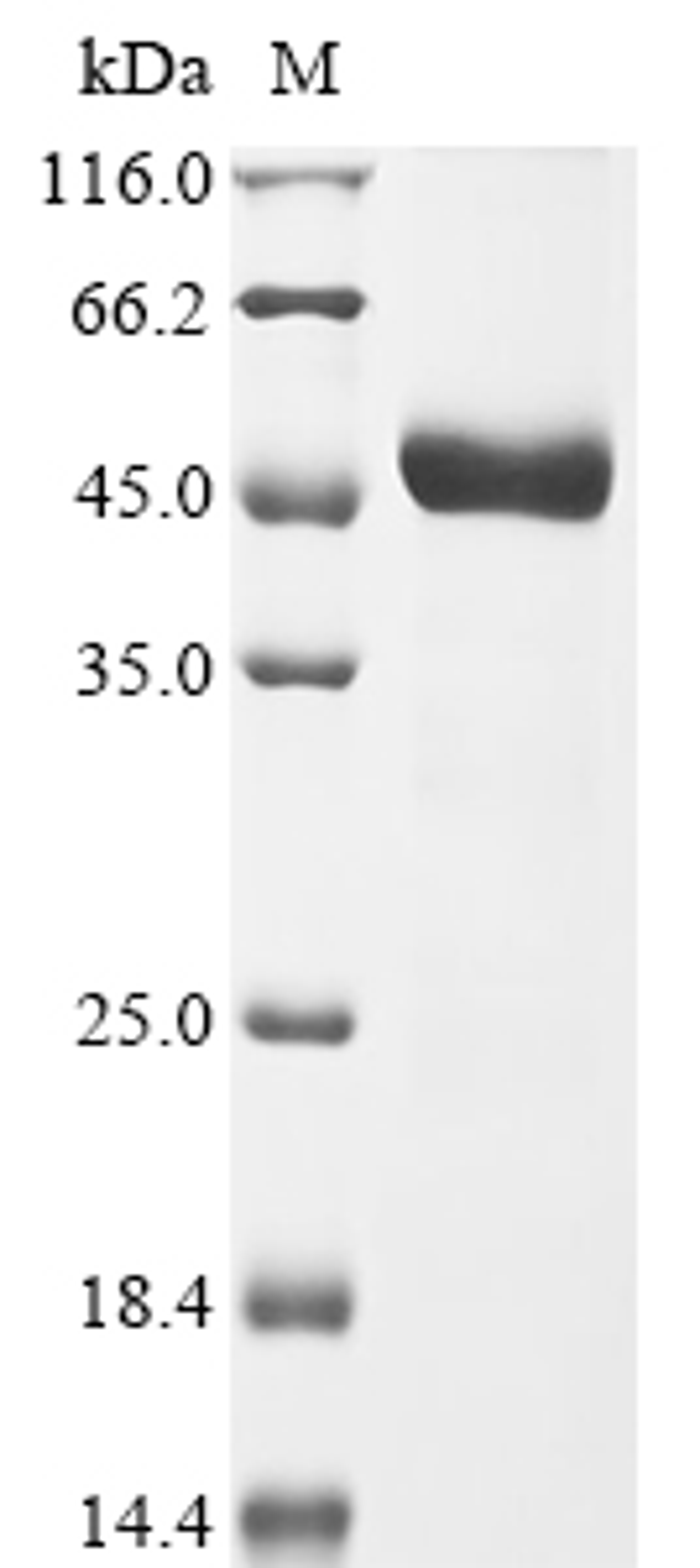 (Tris-Glycine gel) Discontinuous SDS-PAGE (reduced) with 5% enrichment gel and 15% separation gel.