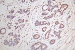 IHC image of CSB-RA006169MA1HU diluted at 1:100 and staining in paraffin-embedded human breast tissue performed on a Leica BondTM system. After dewaxing and hydration,  antigen retrieval was mediated by high pressure in a citrate buffer (pH 6.0). Section was blocked with 10% normal goat serum 30min at RT. Then primary antibody (1% BSA) was incubated at 4°C overnight. The primary is detected by a Goat anti-rabbit polymer IgG labeled by HRP and visualized using 0.05% DAB.