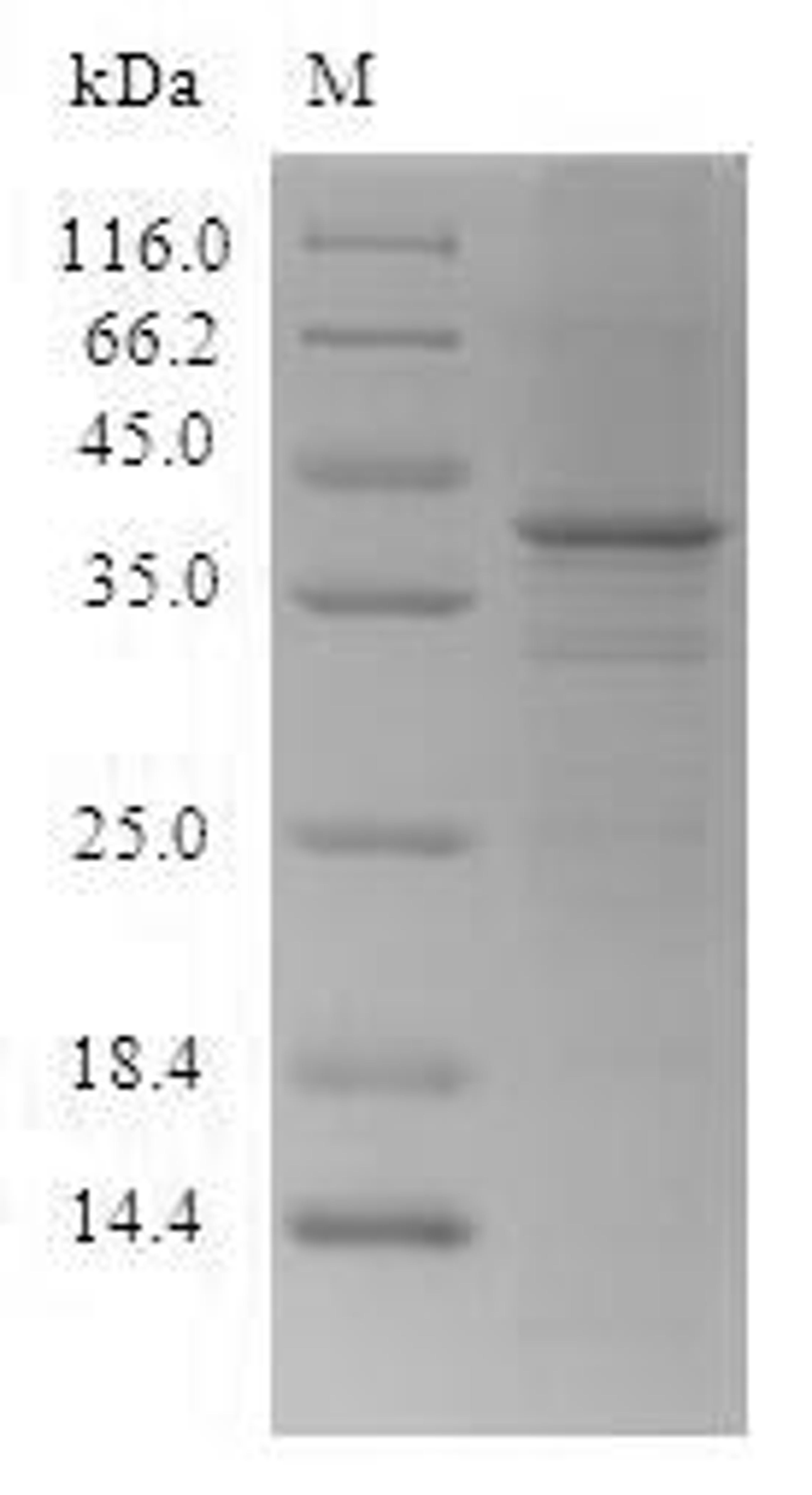 (Tris-Glycine gel) Discontinuous SDS-PAGE (reduced) with 5% enrichment gel and 15% separation gel.