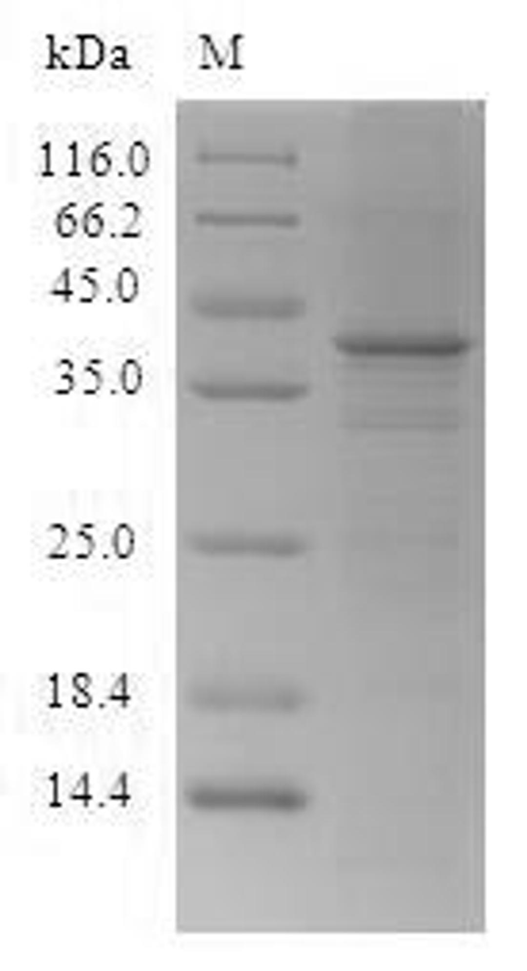 (Tris-Glycine gel) Discontinuous SDS-PAGE (reduced) with 5% enrichment gel and 15% separation gel.