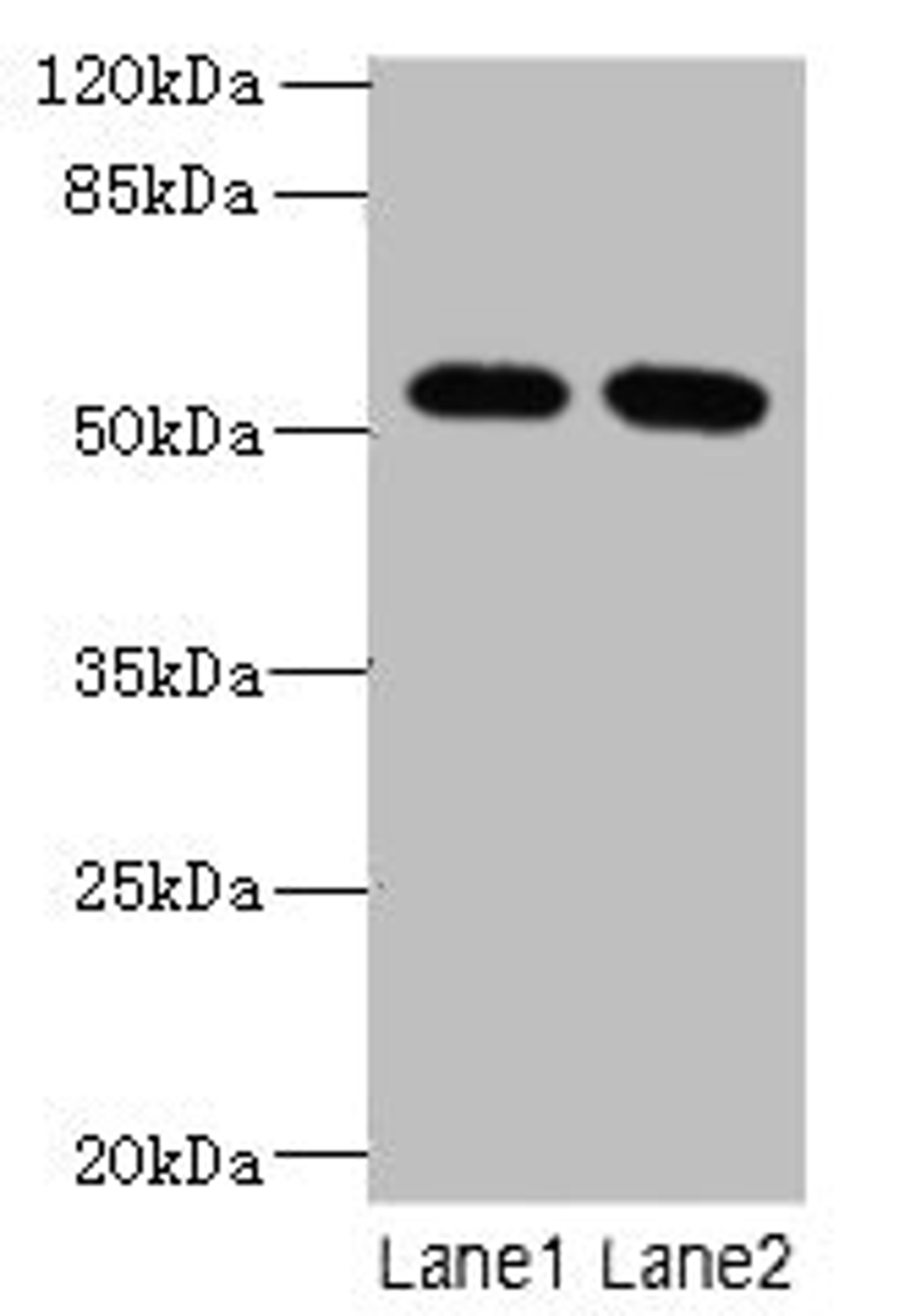 Western blot. All lanes: INTS14 antibody at 4µg/ml. Lane 1: Hela whole cell lysate. Lane 2: NIH/3T3 whole cell lysate. Secondary. Goat polyclonal to rabbit IgG at 1/10000 dilution. Predicted band size: 58, 10, 49, 51 kDa. Observed band size: 58 kDa