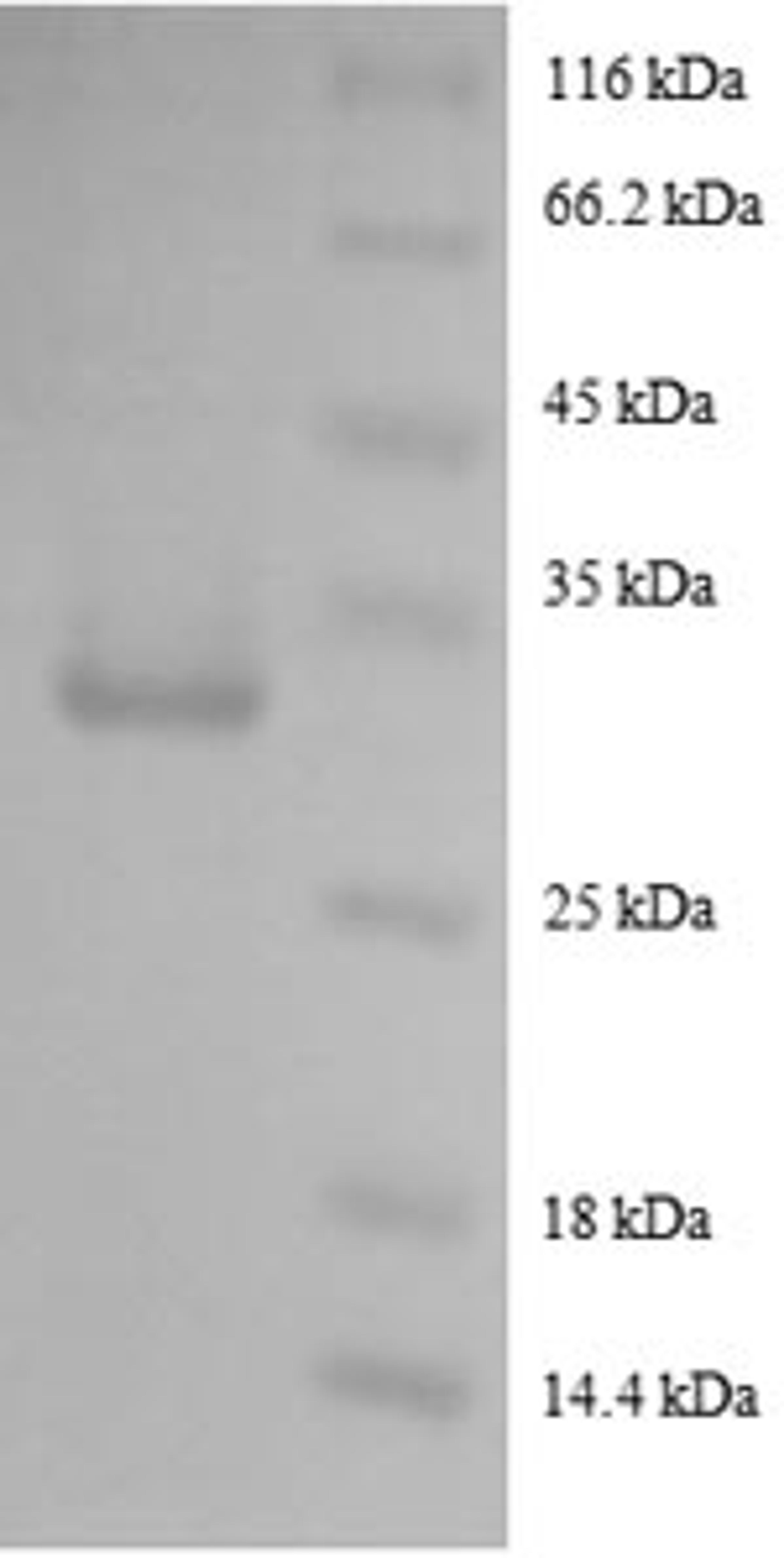 (Tris-Glycine gel) Discontinuous SDS-PAGE (reduced) with 5% enrichment gel and 15% separation gel.