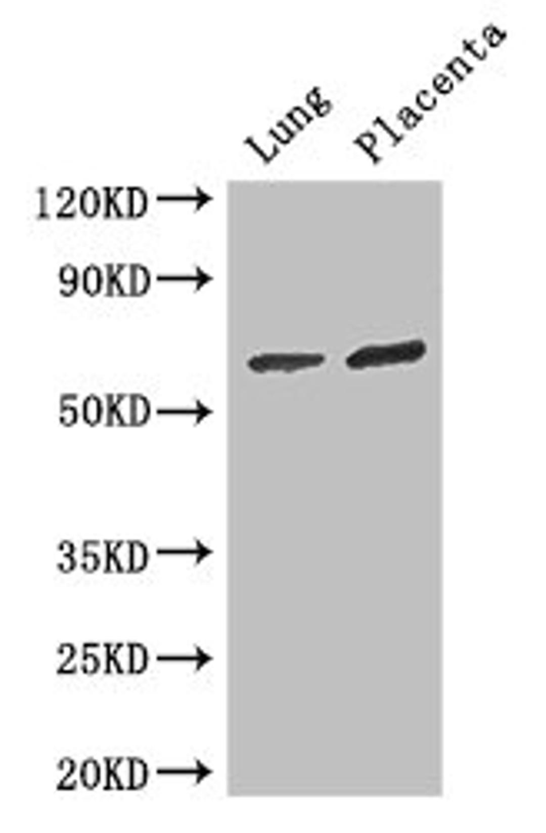 Western Blot. Positive WB detected in: Mouse lung tissue, Human placenta tissue. All lanes: STAU1 antibody at 3ug/ml. Secondary. Goat polyclonal to rabbit IgG at 1/50000 dilution. Predicted band size: 64, 55, 56 kDa. Observed band size: 64 kDa. 