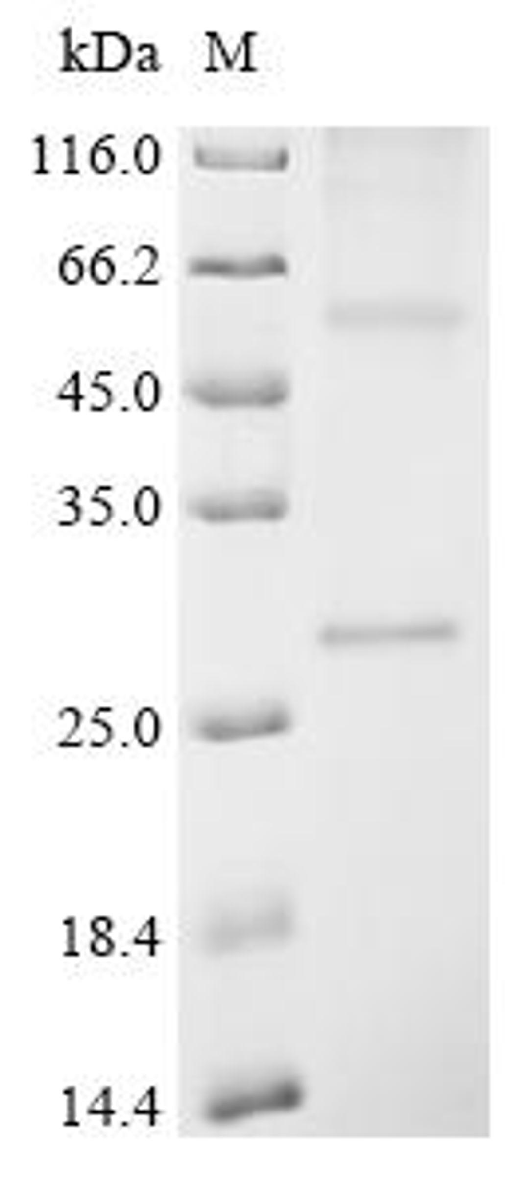 (Tris-Glycine gel) Discontinuous SDS-PAGE (reduced) with 5% enrichment gel and 15% separation gel.
