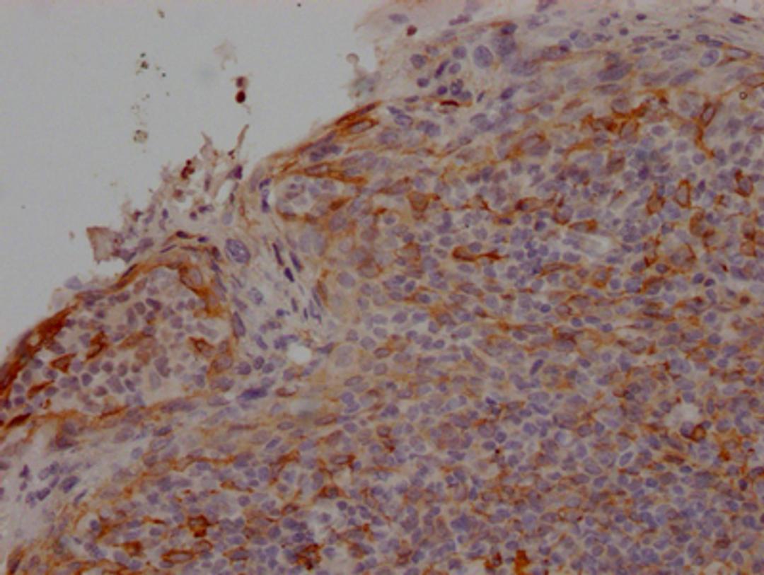 IHC image of CSB-RA297464A0HU diluted at 1:100 and staining in paraffin-embedded human tonsil tissue performed on a Leica BondTM system. After dewaxing and hydration, antigen retrieval was mediated by high pressure in a citrate buffer (pH 6.0). Section was blocked with 10% normal goat serum 30min at RT. Then primary antibody (1% BSA) was incubated at 4℃ overnight. The primary is detected by a Goat anti-rabbit IgG polymer labeled by HRP and visualized using 0.05% DAB.