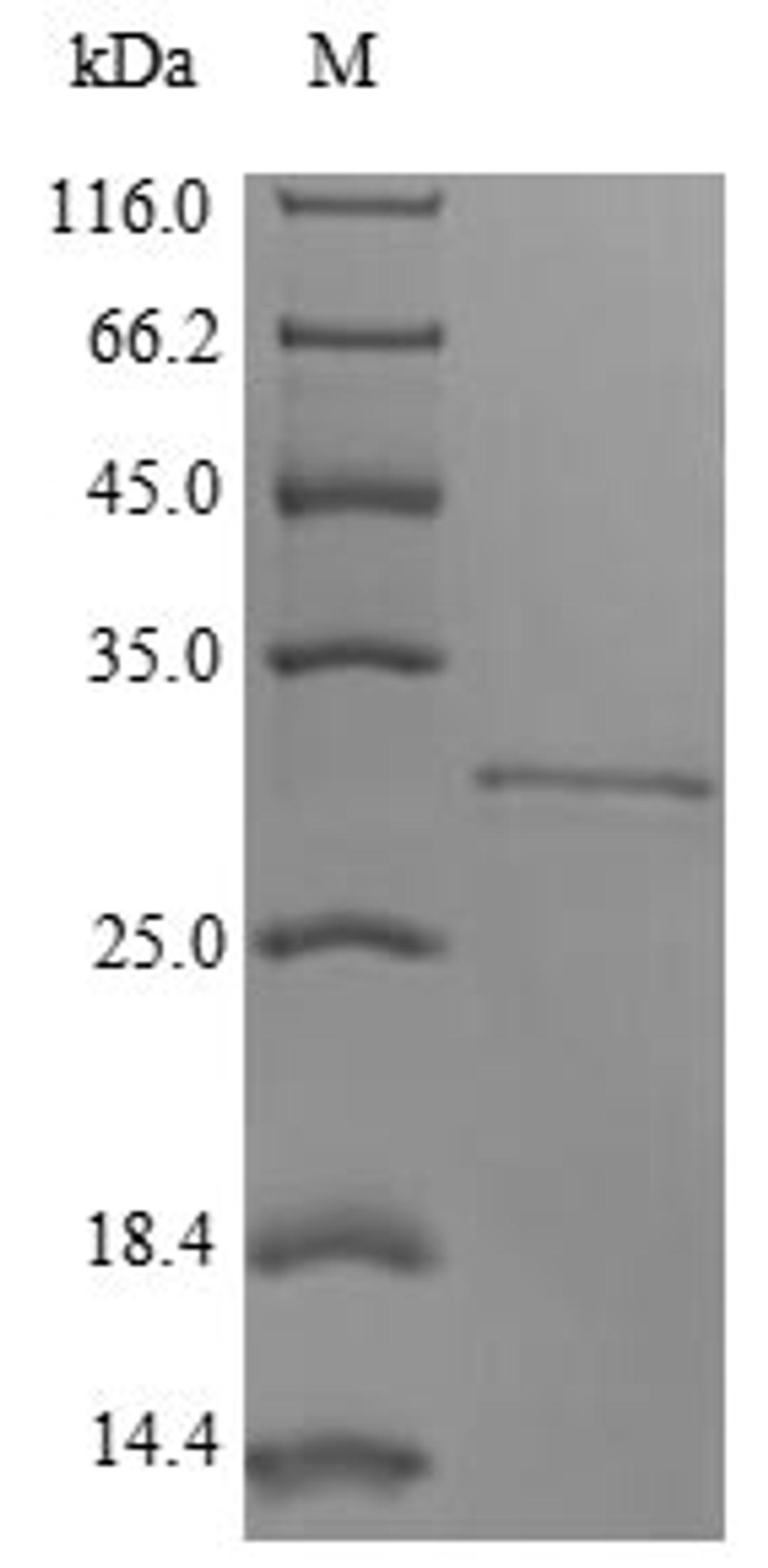 (Tris-Glycine gel) Discontinuous SDS-PAGE (reduced) with 5% enrichment gel and 15% separation gel.
