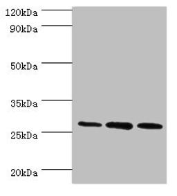 Western blot. All lanes: ORC6 antibody at 16ug/ml. Lane 1: Mouse spleen tissue. Lane 2: MCF-7 whole cell lysate. Lane 3: Hela whole cell lysate. Secondary. Goat polyclonal to rabbit IgG at 1/10000 dilution. Predicted band size: 28 kDa. Observed band size: 28 kDa. 