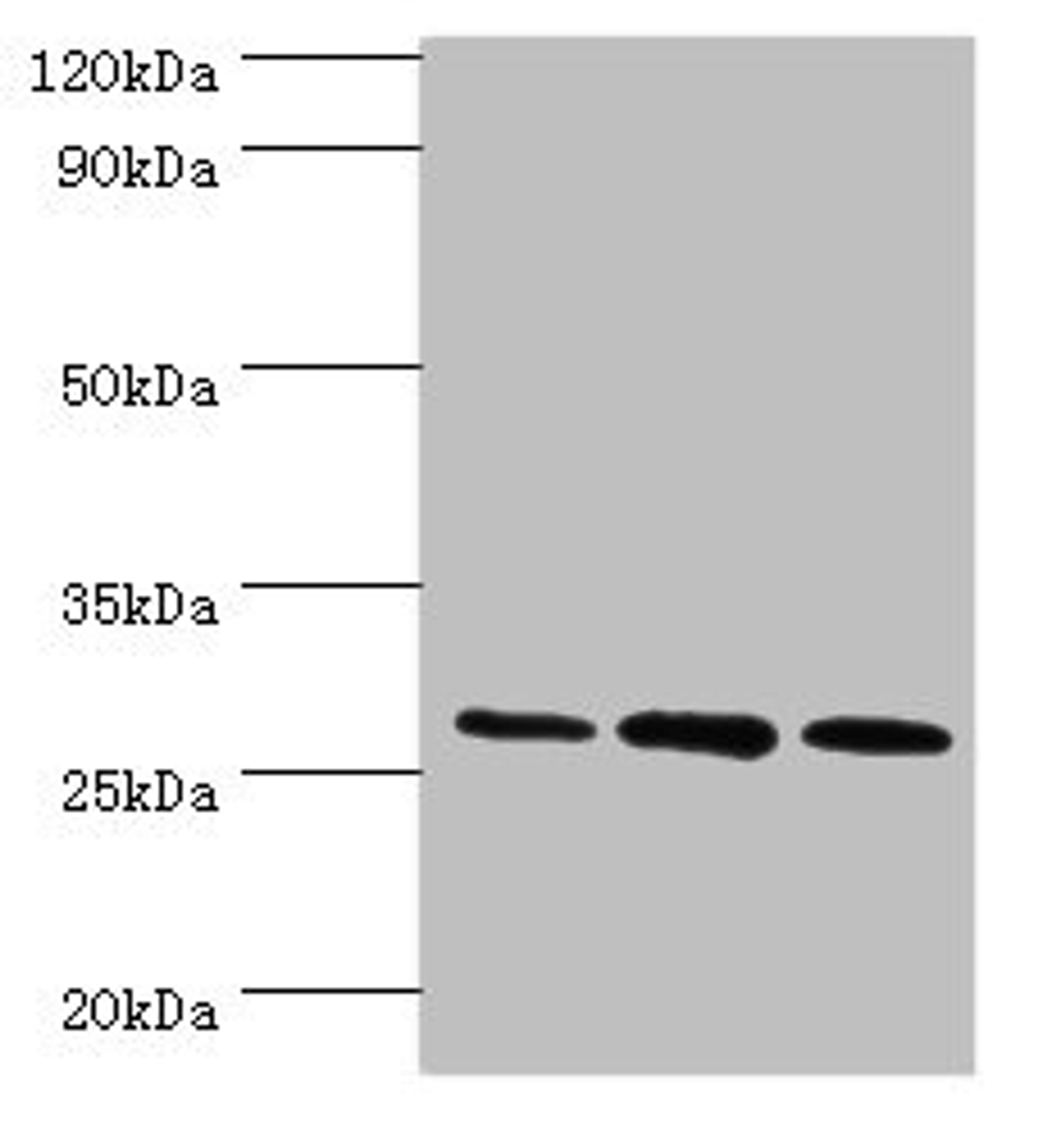 Western blot. All lanes: ORC6 antibody at 16ug/ml. Lane 1: Mouse spleen tissue. Lane 2: MCF-7 whole cell lysate. Lane 3: Hela whole cell lysate. Secondary. Goat polyclonal to rabbit IgG at 1/10000 dilution. Predicted band size: 28 kDa. Observed band size: 28 kDa.